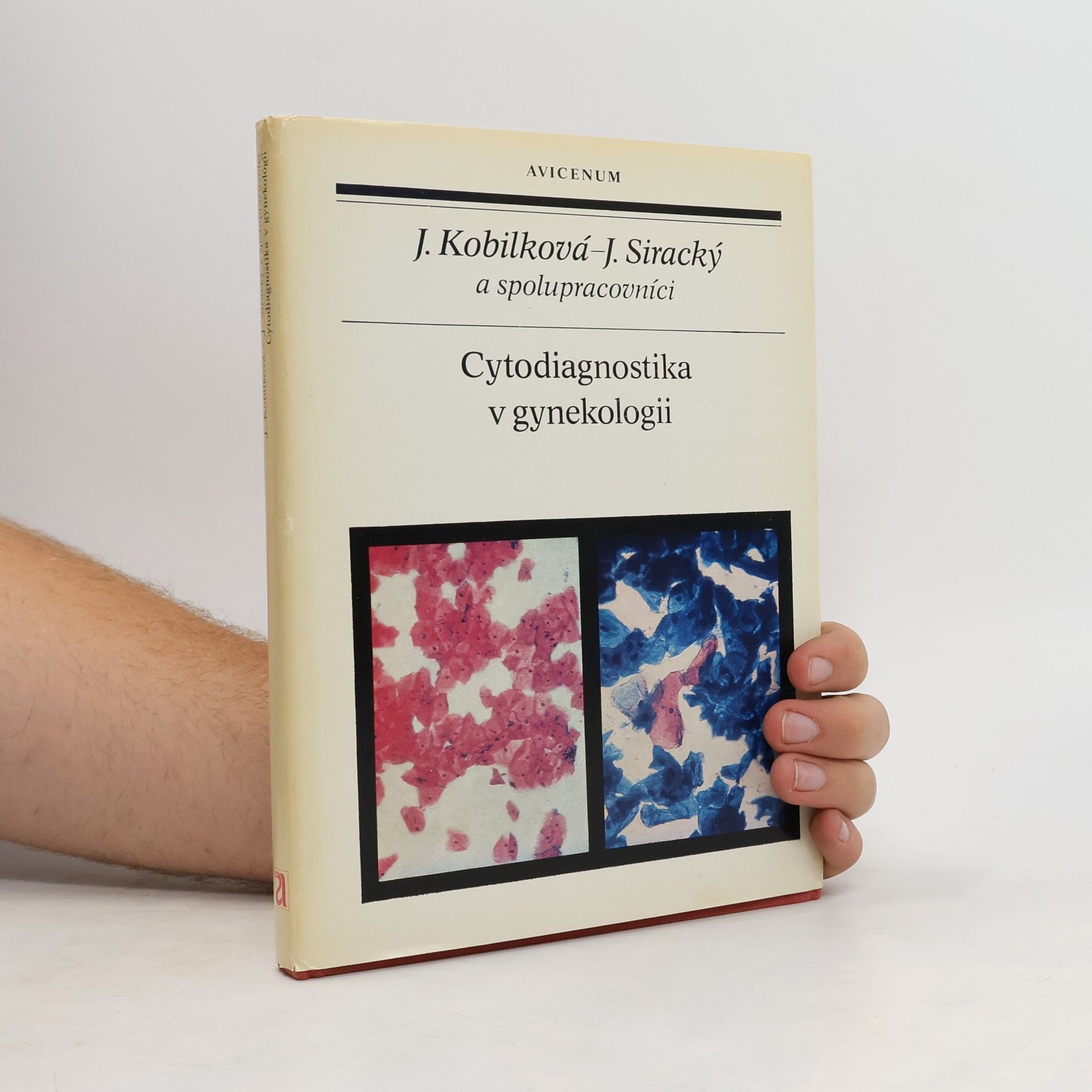 Ján Siracký Cytodiagnostika v gynekologii