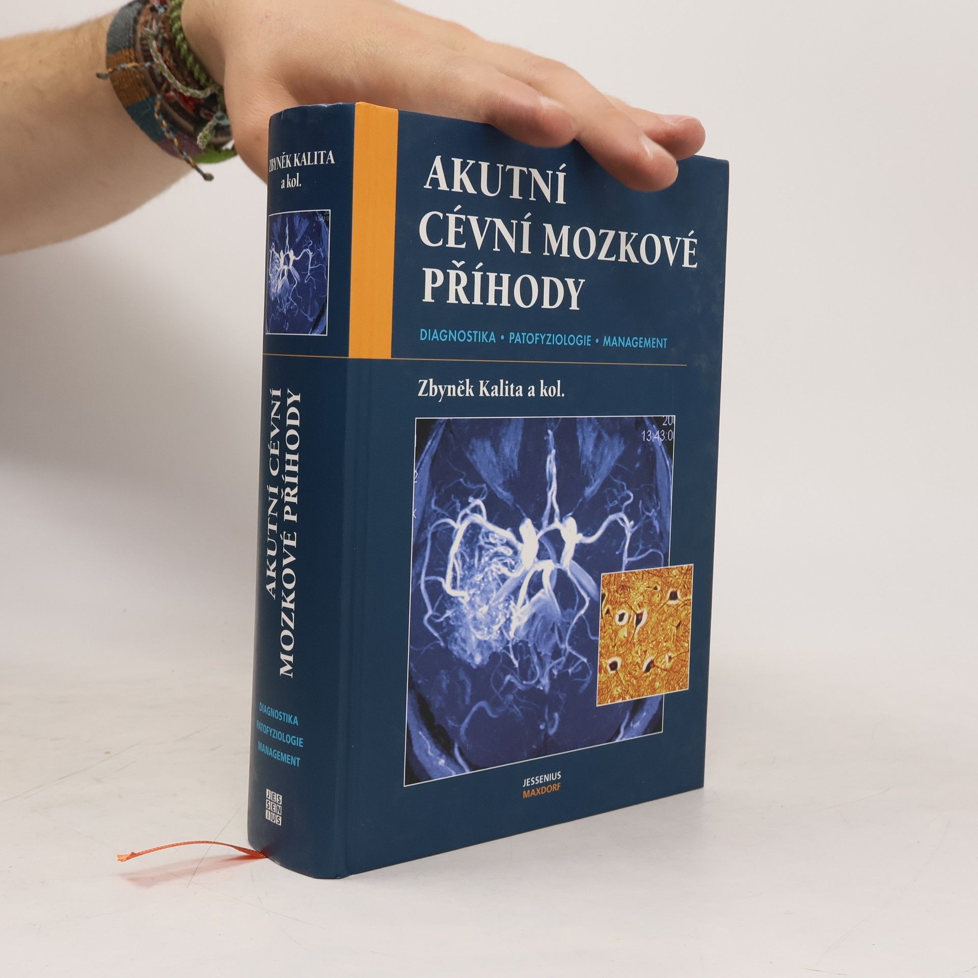 Zbyněk Kalita Akutní cévní mozkové příhody . diagnostika, patofyziologie, management