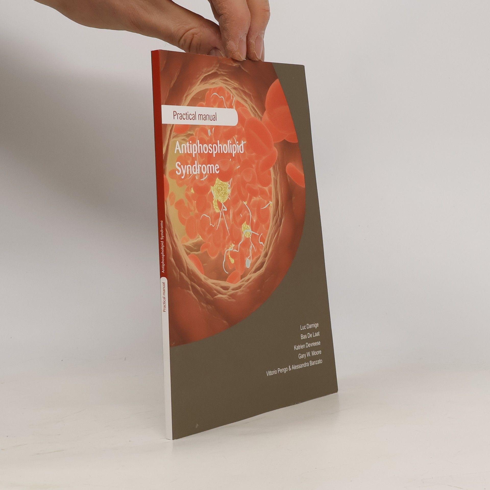 Autorenkollektiv Practical manual Antiphospholipid Syndrome