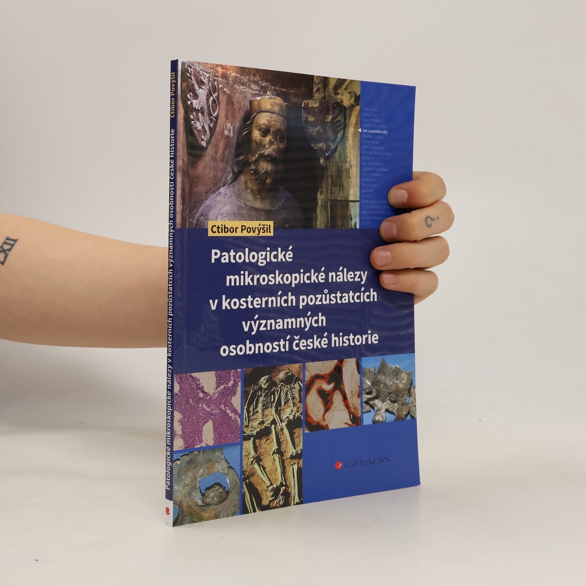 Ctibor Povýšil Patologické mikroskopické nálezy v kosterních pozůstatcích významných osobností české historie