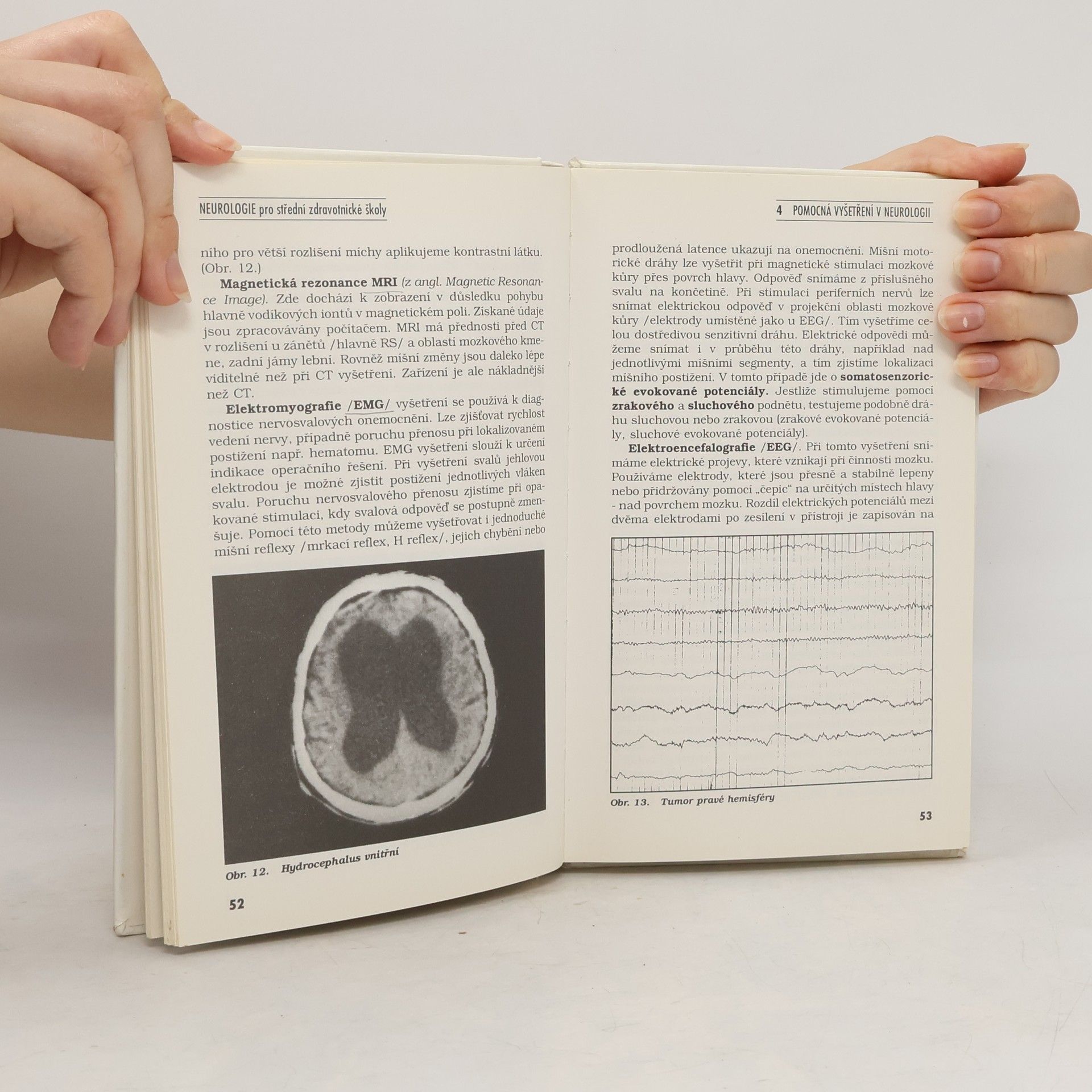 Pavel Jedlička Neurologie pro střední zdravotnické školy