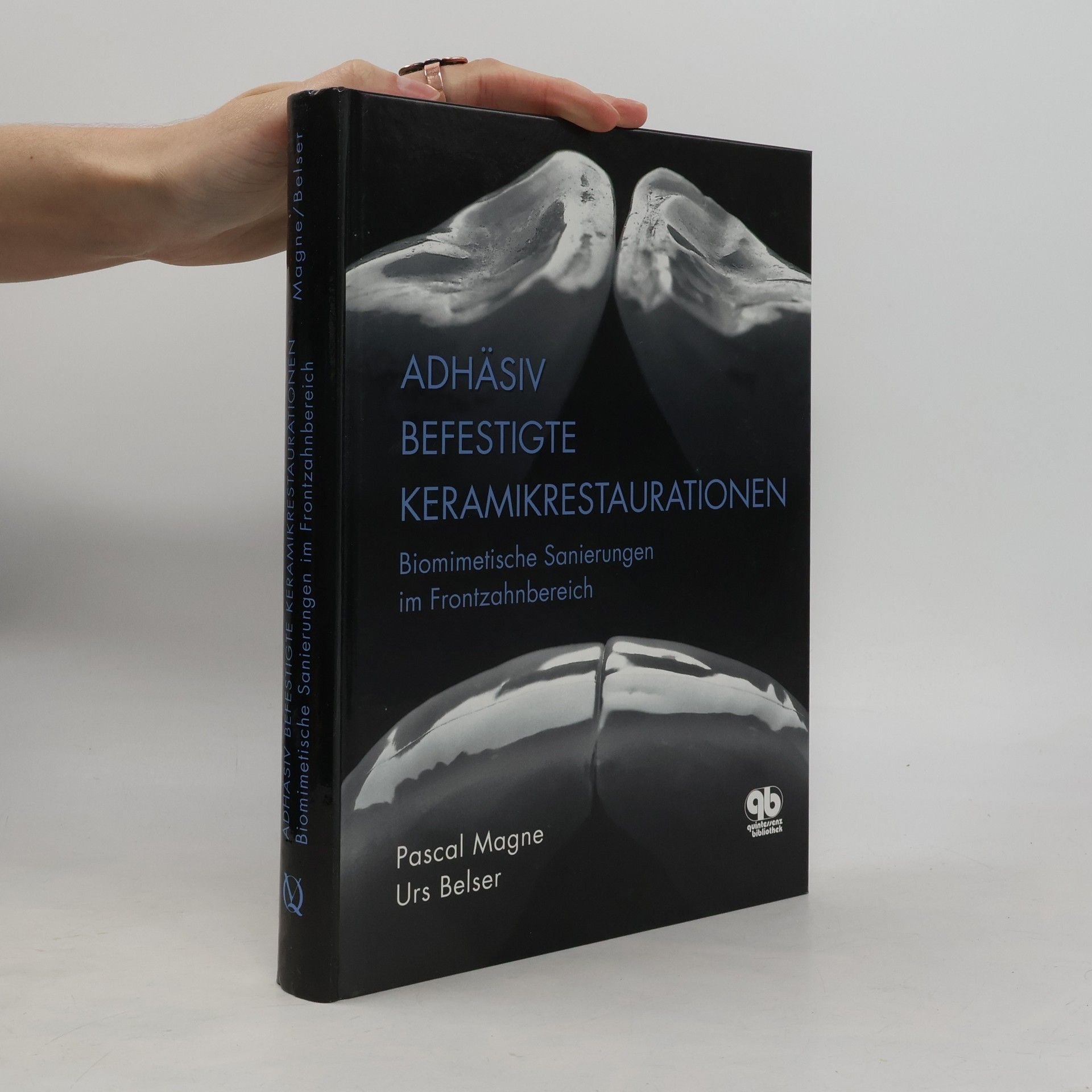 Pascal Magne Adhäsiv befestigte Keramikrestaurationen