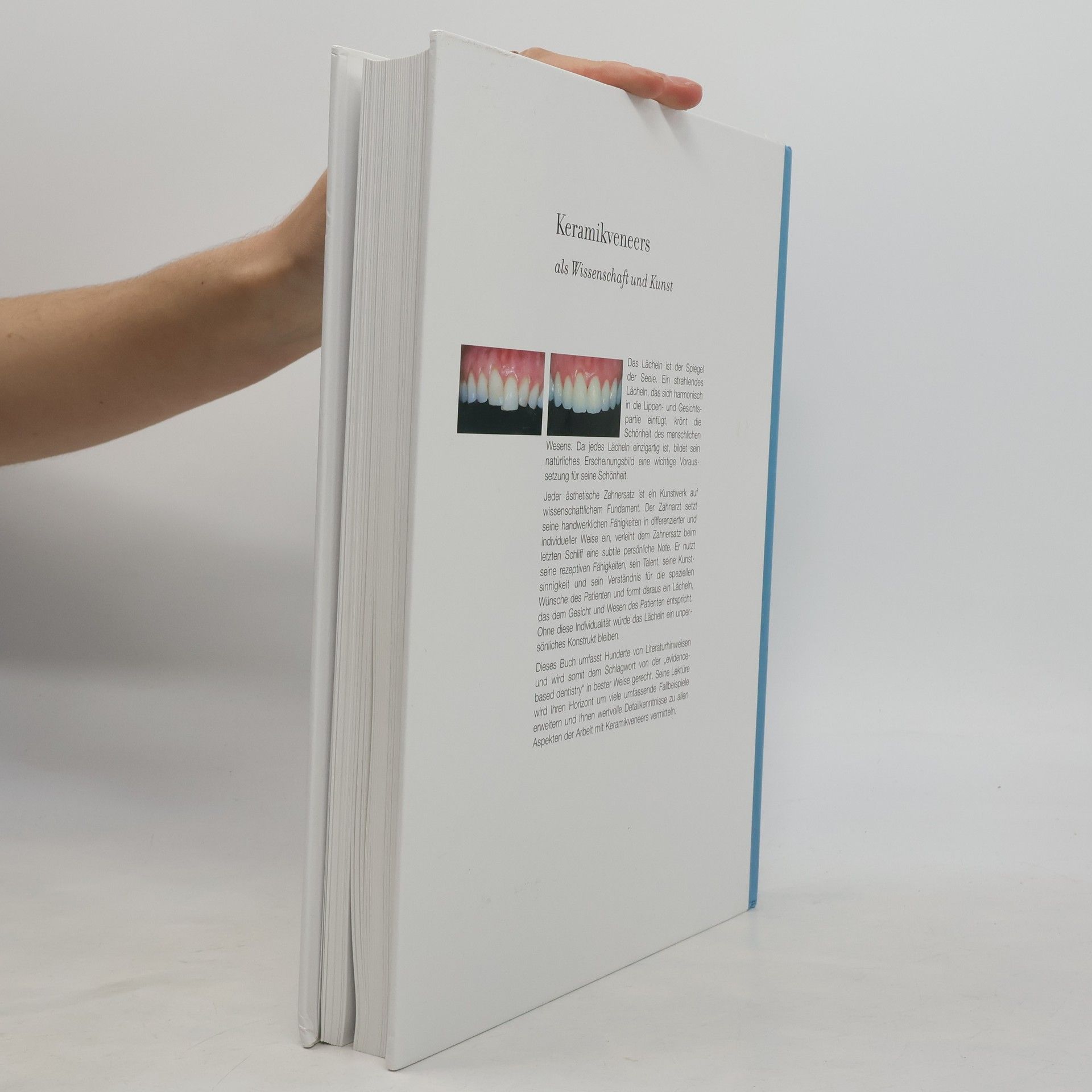 Galip Gürel Keramikverneers als Wissenschaft und Kunst