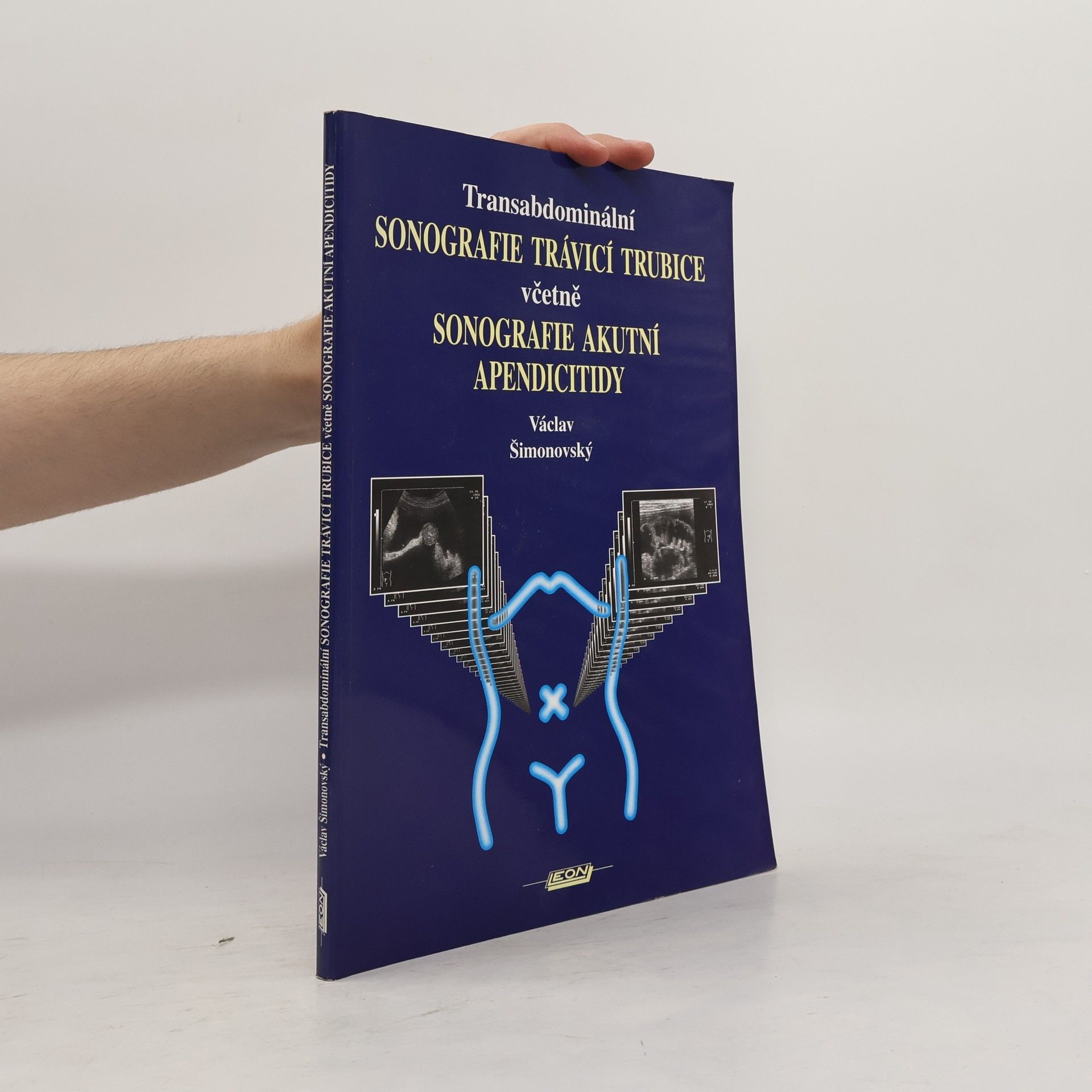 Václav Šimonovský Transabdominální sonografie trávicí trubice včetně sonografie akutní apendicitidy