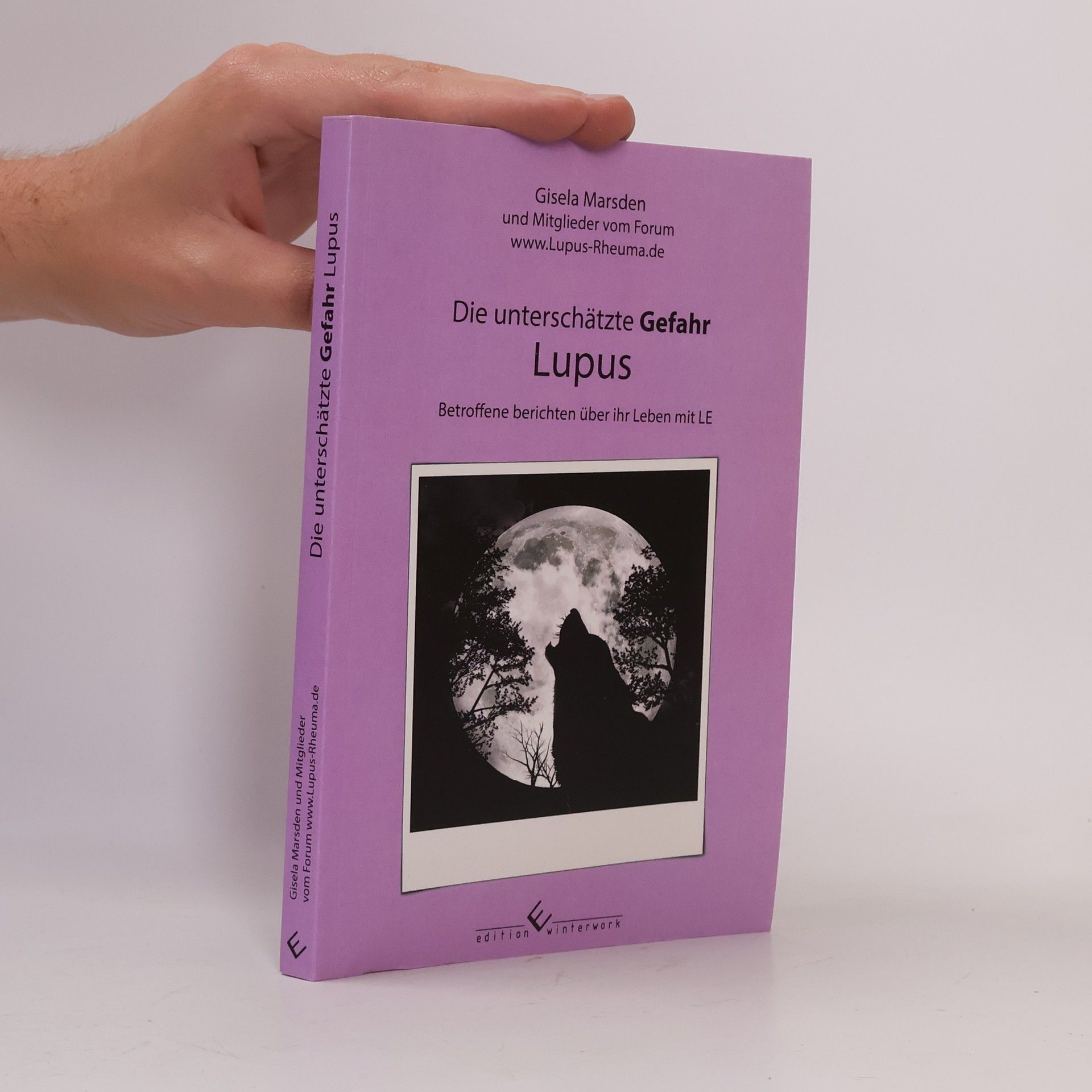 Mitglieder vom Forum www.Lupus-Rheuma.de Die unterschätzte Gefahr Lupus
