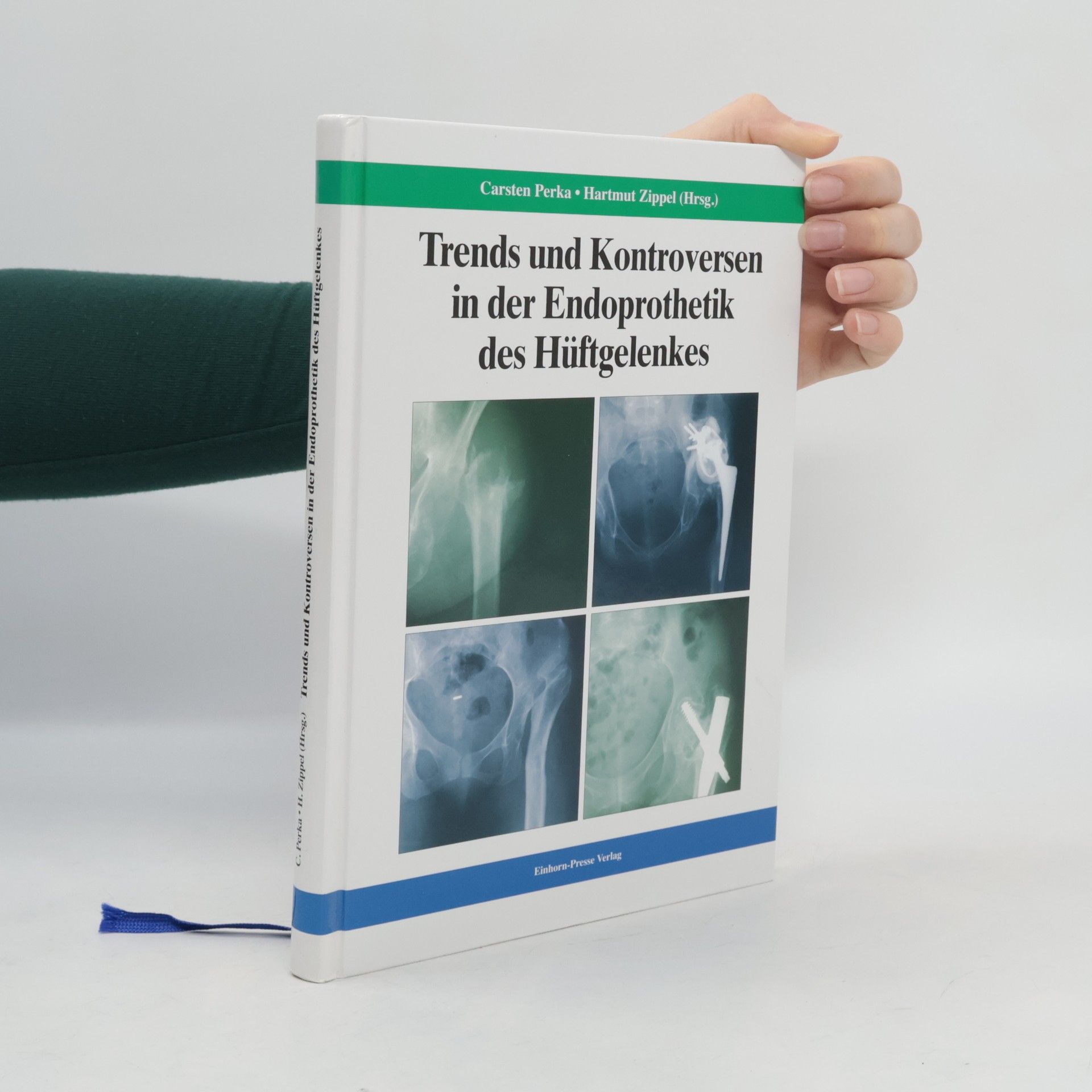 Hartmut Zippel Trends und Kontroversen in der Endoprothetik des Hüftgelenkes