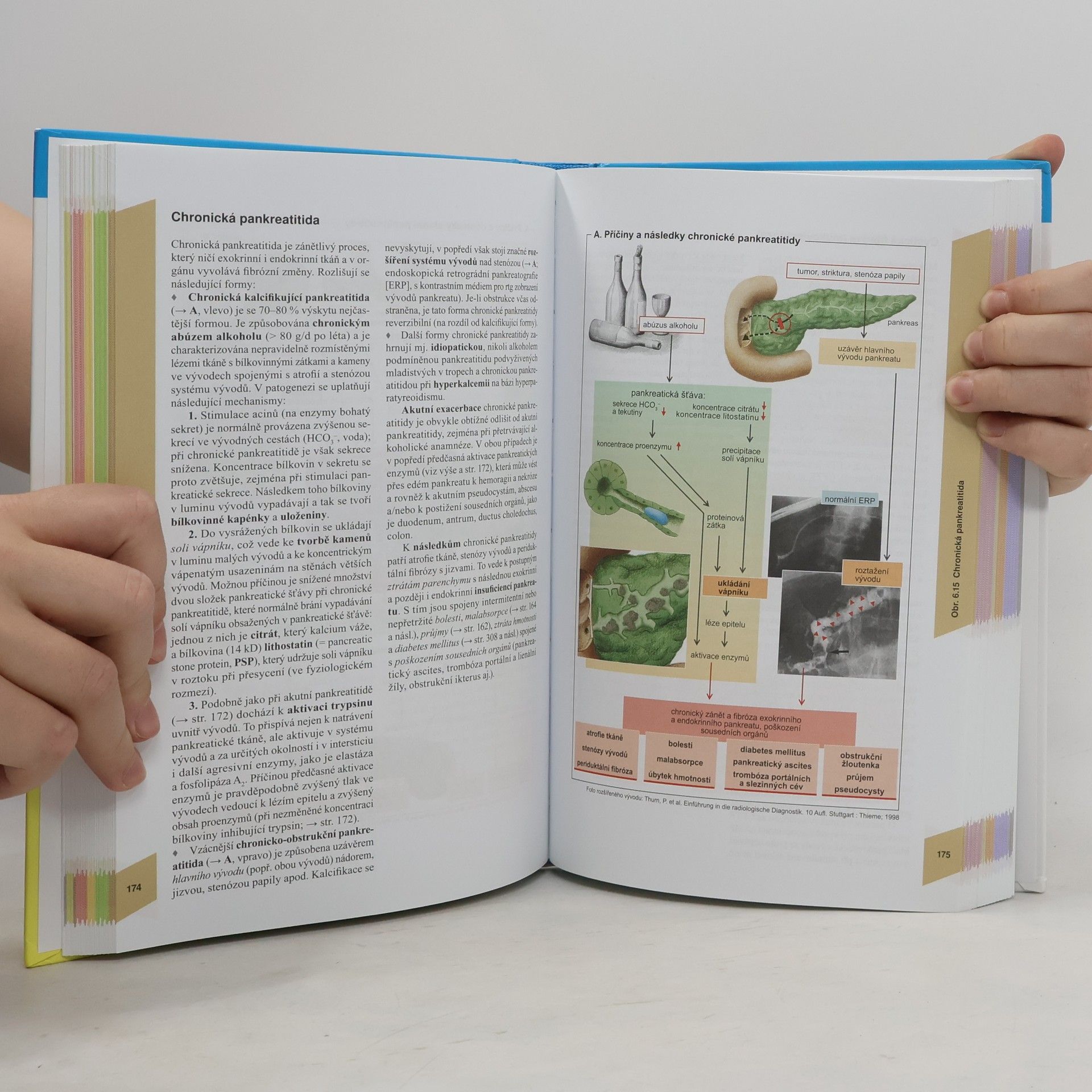 Stefan Silbernagl Atlas patofyziologie
