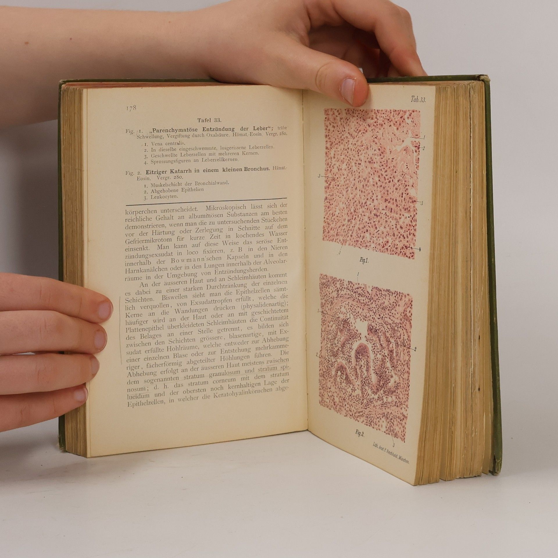 Hermann Dürck Atlas und Grundriss der allgemeinen pathologischen Histologie