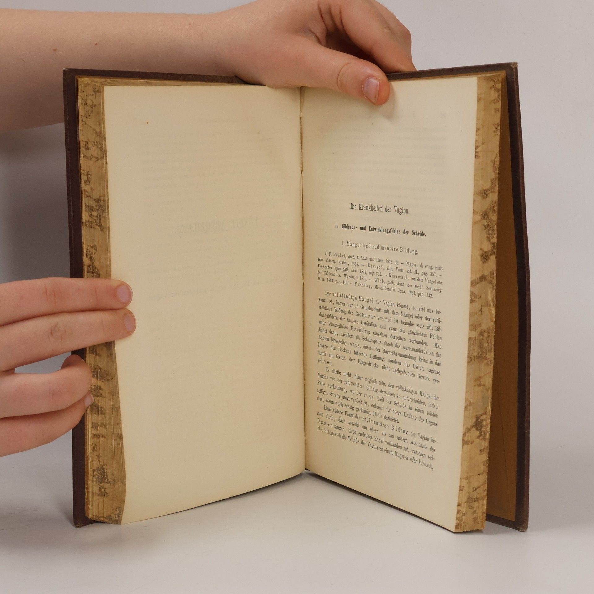 F. W. Von Scanzoni Lehrbuch der Krankheiten der Weiblichen Sexualorgane 2