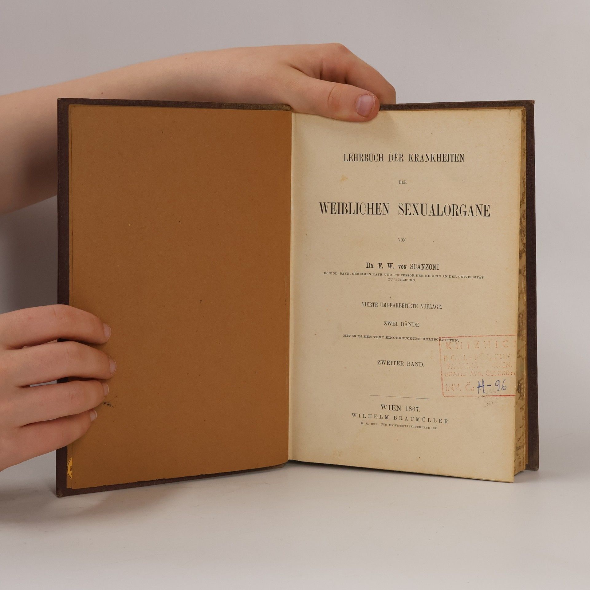 F. W. Von Scanzoni Lehrbuch der Krankheiten der Weiblichen Sexualorgane 2