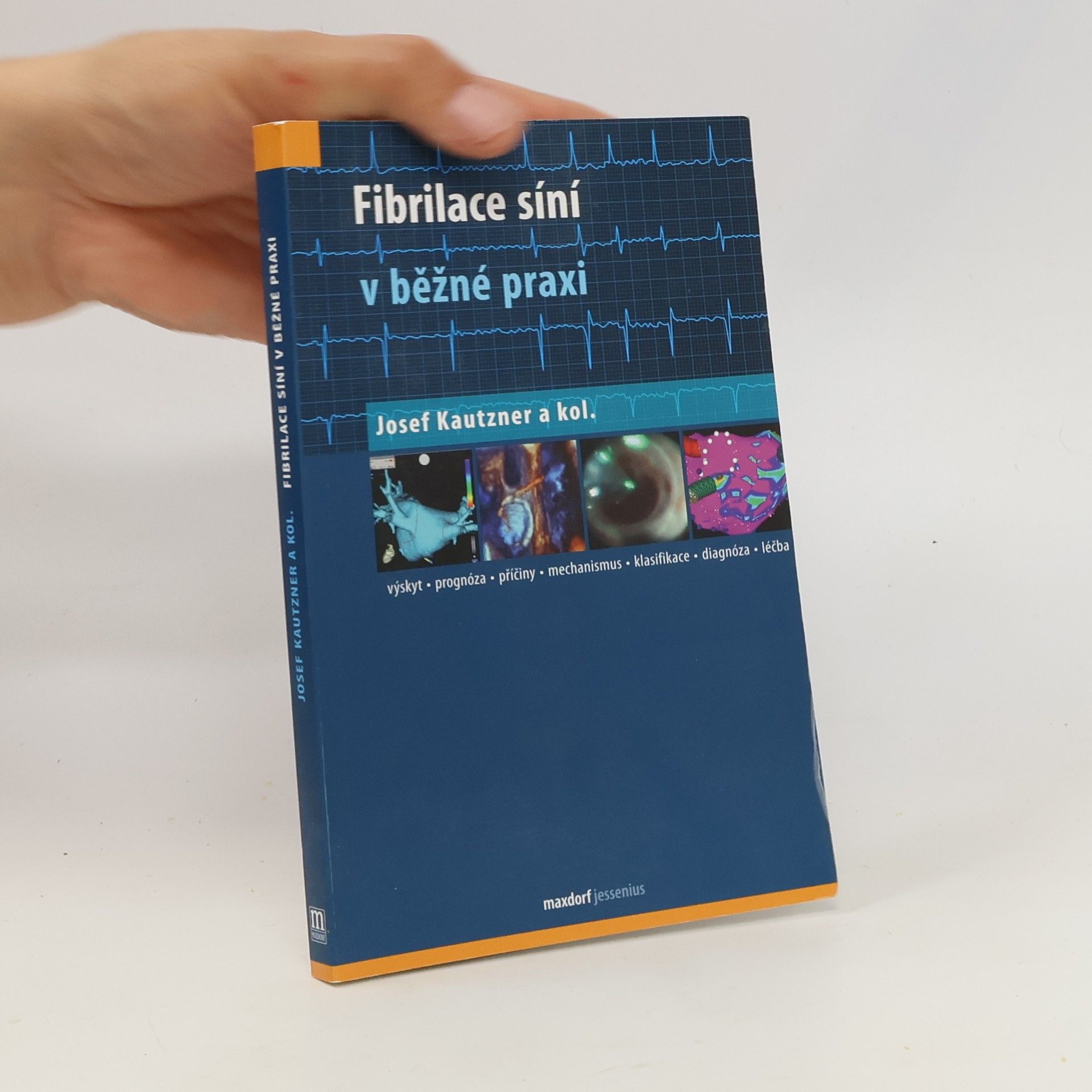 Josef Kautzner Fibrilace síní v běžné praxi