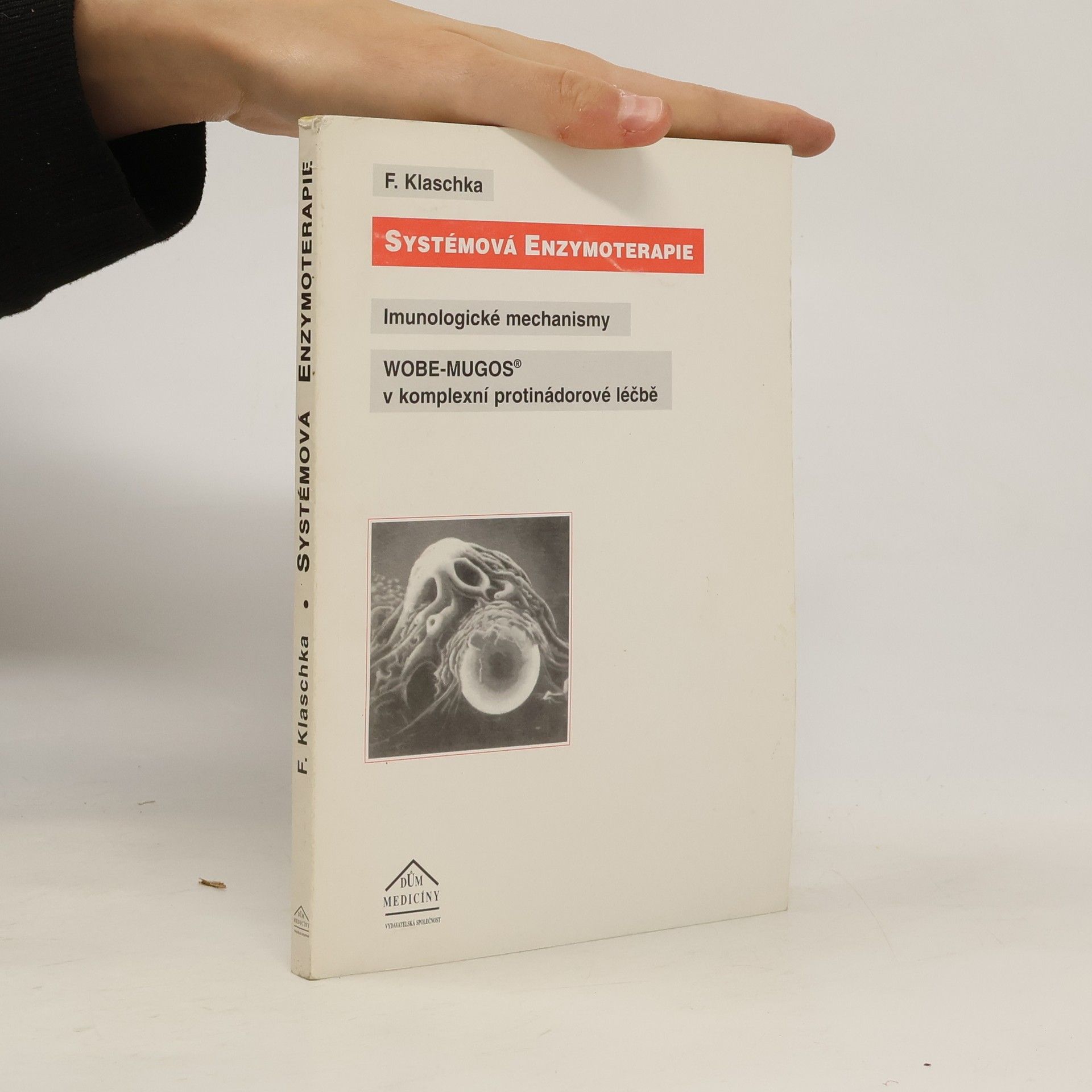Systémová enzymoterapie : imunologické mechanismy WOBE-MUGOS v komplexní protinádorové léčbě