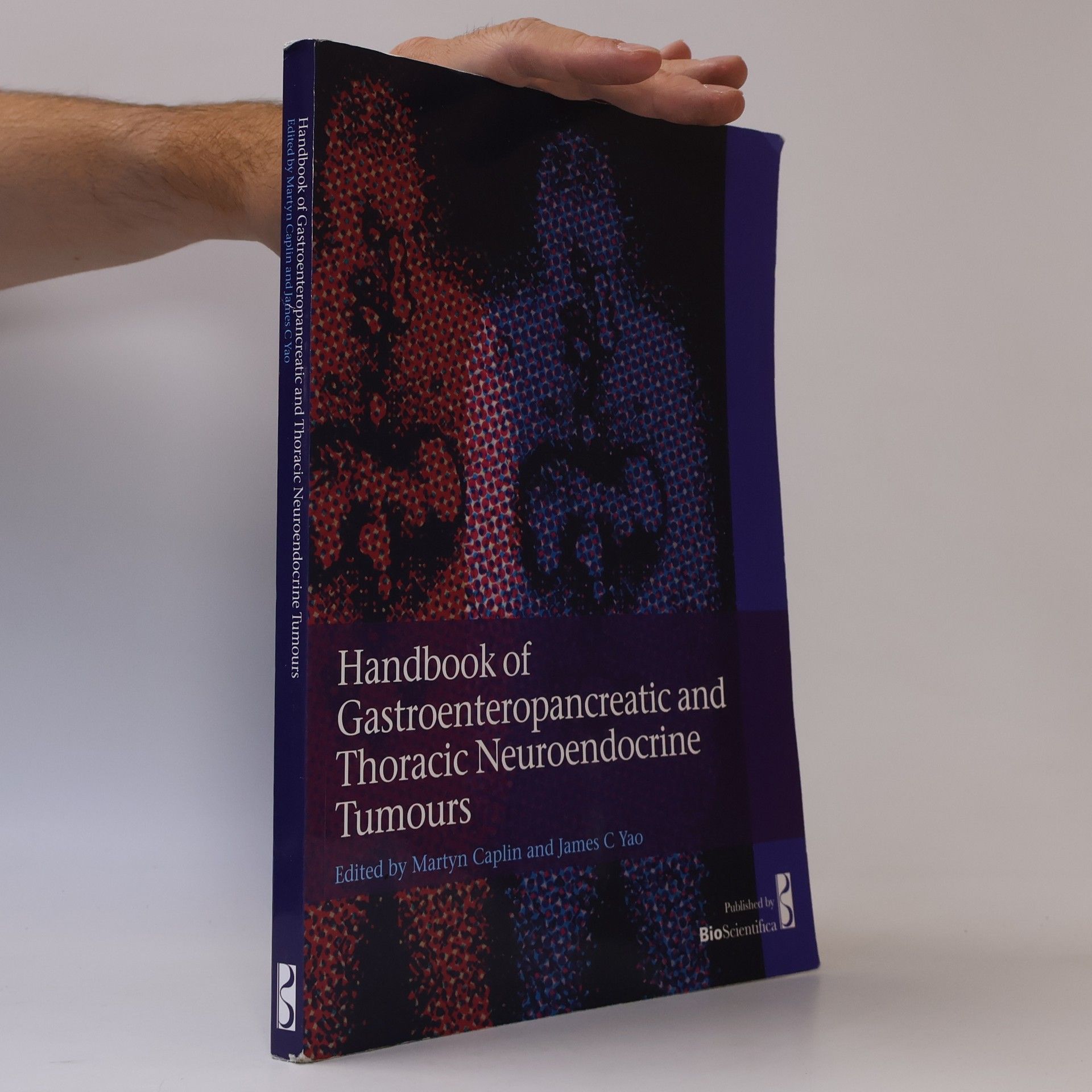 Handbook of Gastroenteropancreatic and Thoracic Neuroendocrine Tumours