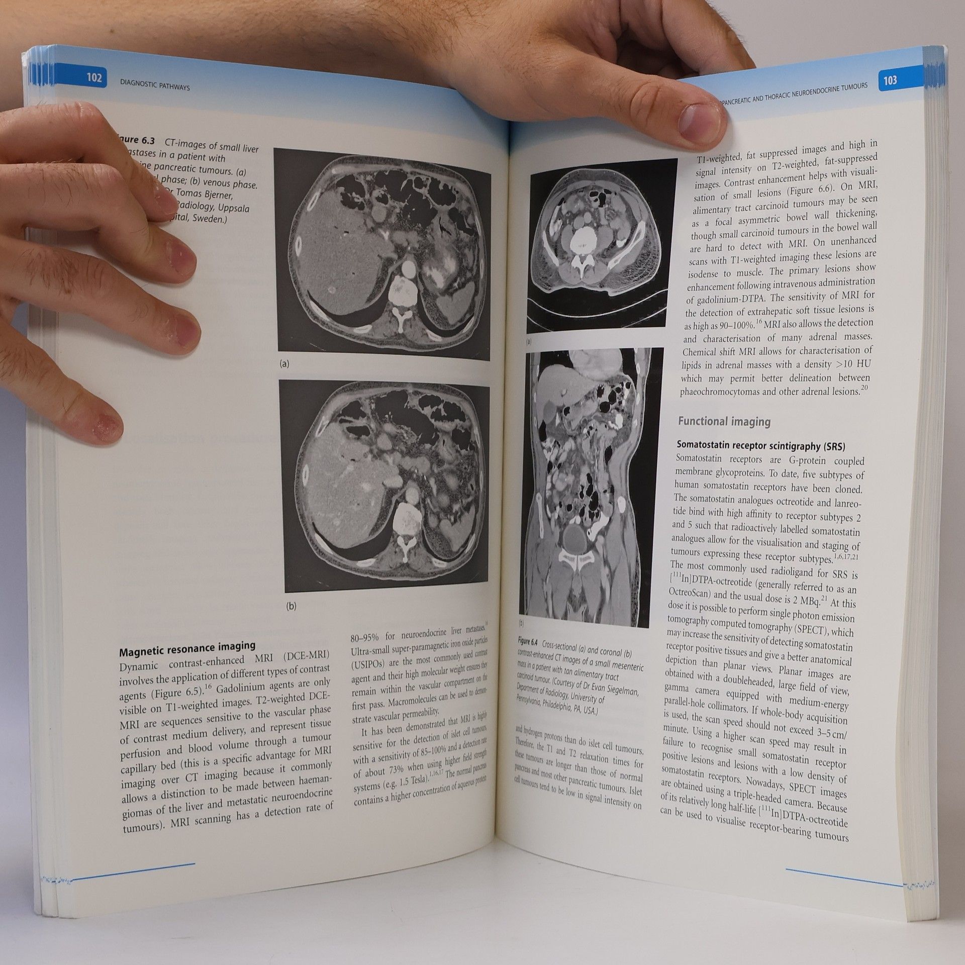 Martyn Evan Caplin Handbook of Gastroenteropancreatic and Thoracic Neuroendocrine Tumours