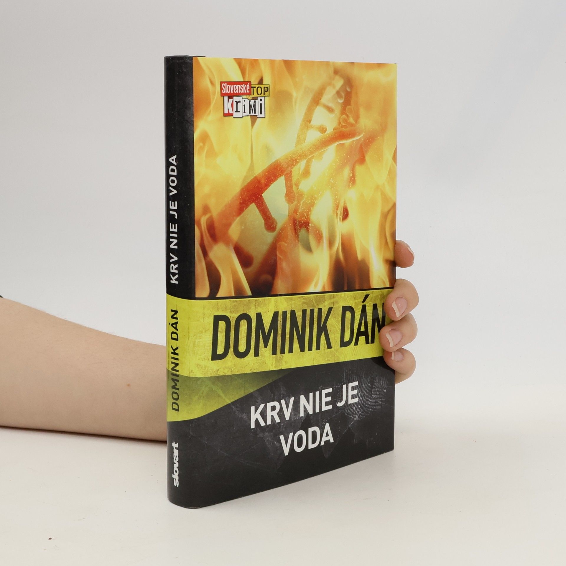 Krv nie je voda