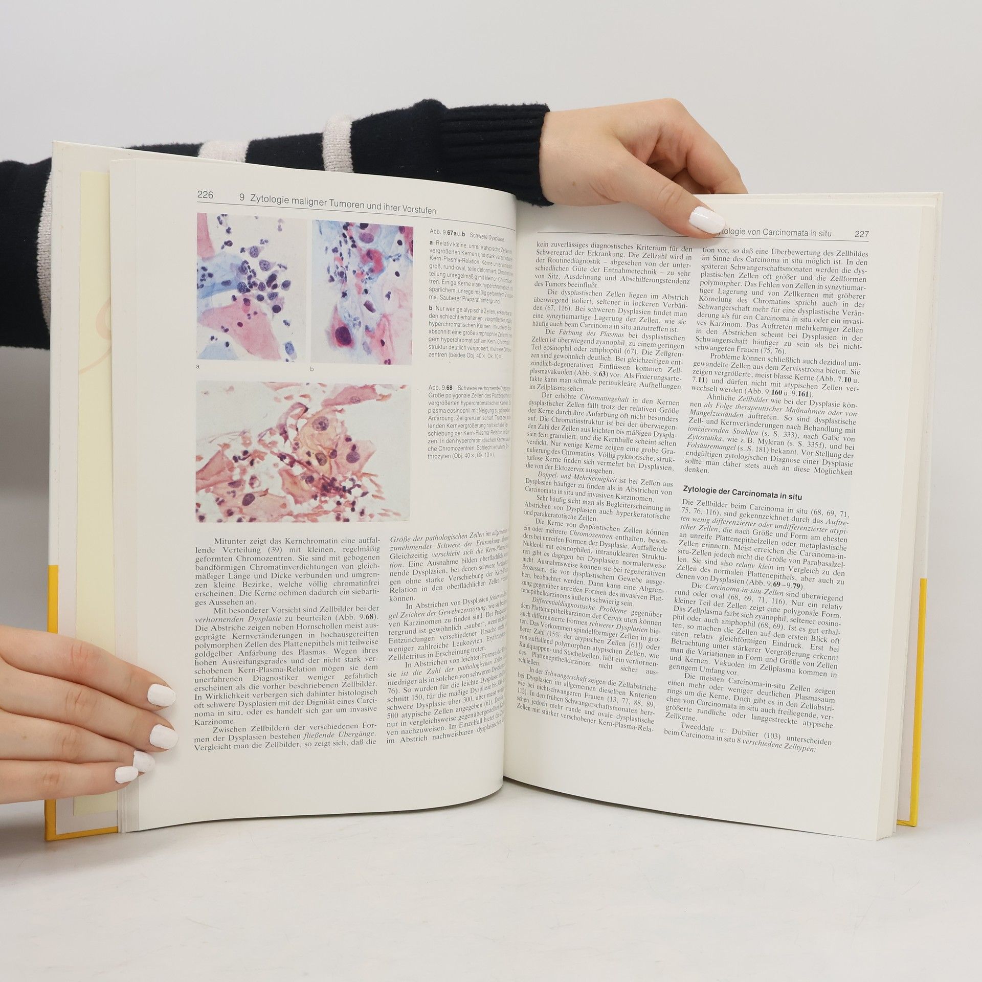 Hans-Jürgen Soost Gynäkologische Zytodiagnostik: Lehrbuch und Atlas 2