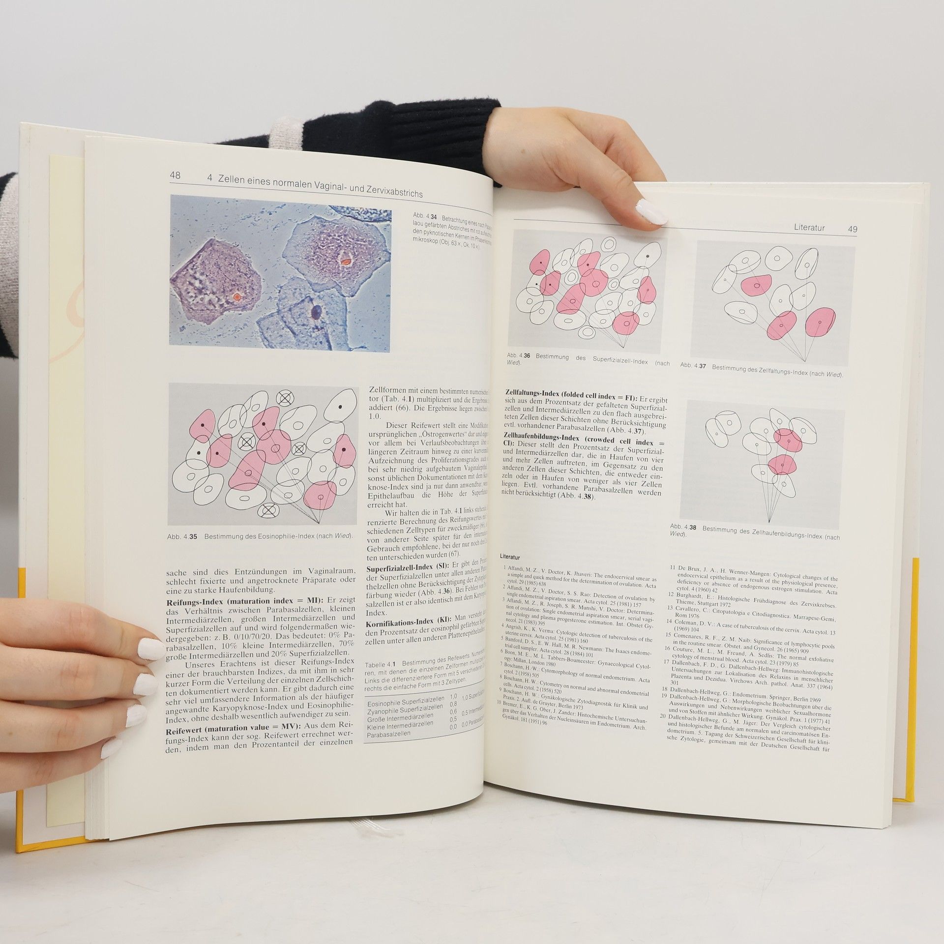 Hans-Jürgen Soost Gynäkologische Zytodiagnostik 1