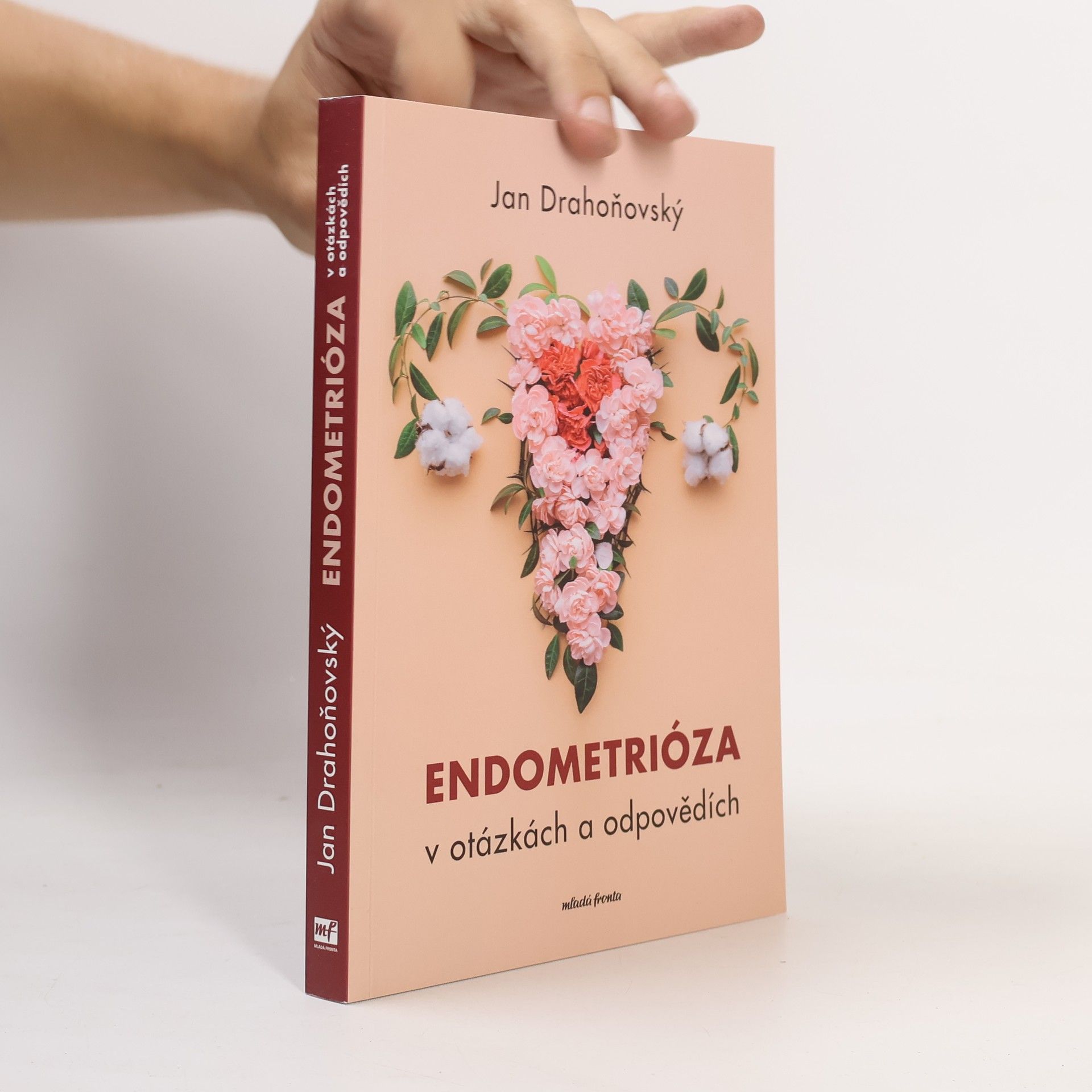 Jan Drahoňovský Endometrióza v otázkách a odpovědích
