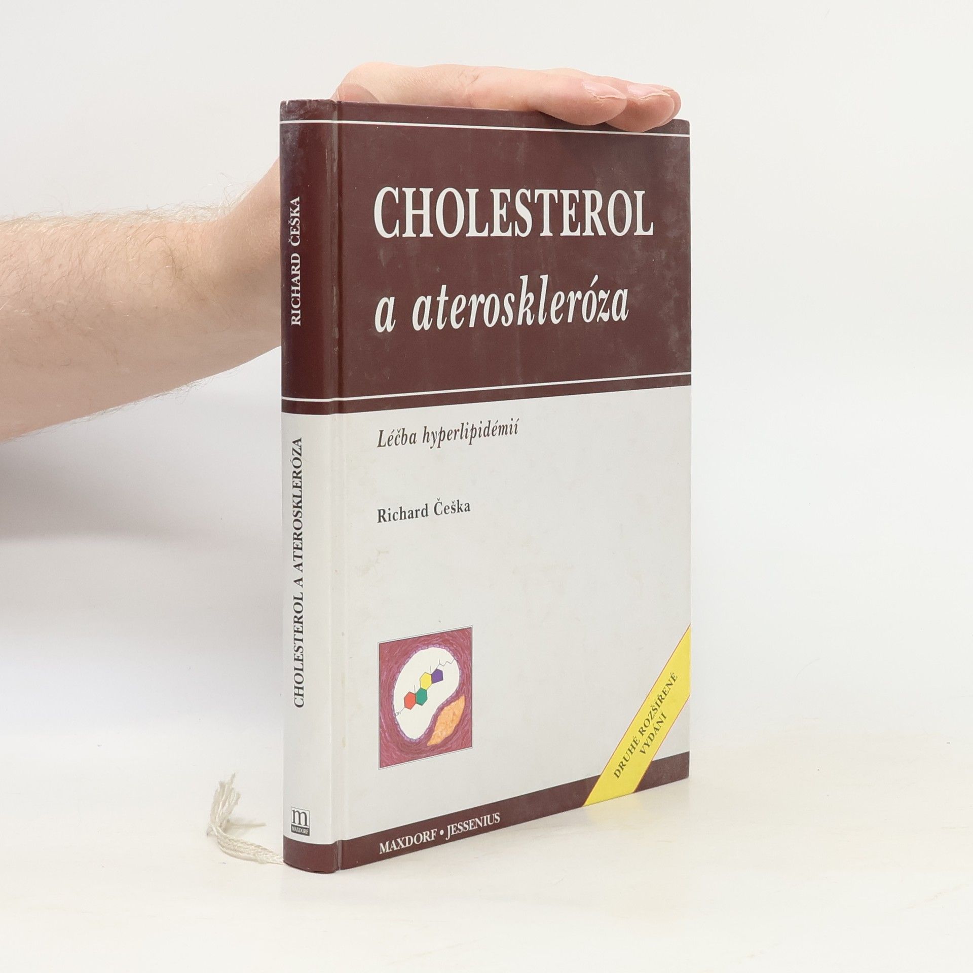 Richard Češka Cholesterol a ateroskleróza: Léčba hyperlipidémií