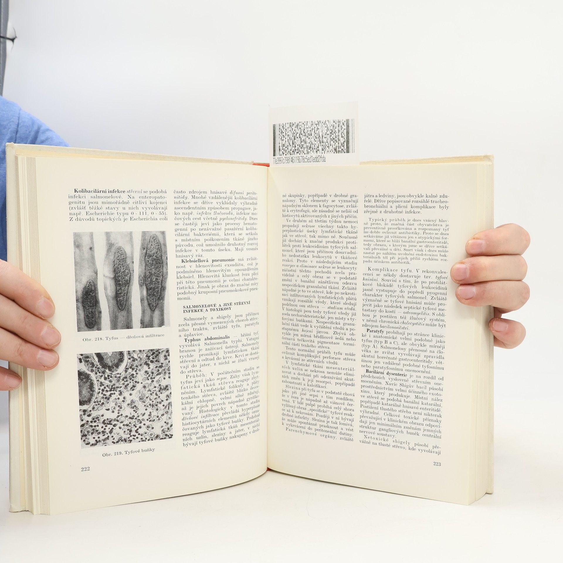 Blahoslav Bednář Učebnice patologické anatomie