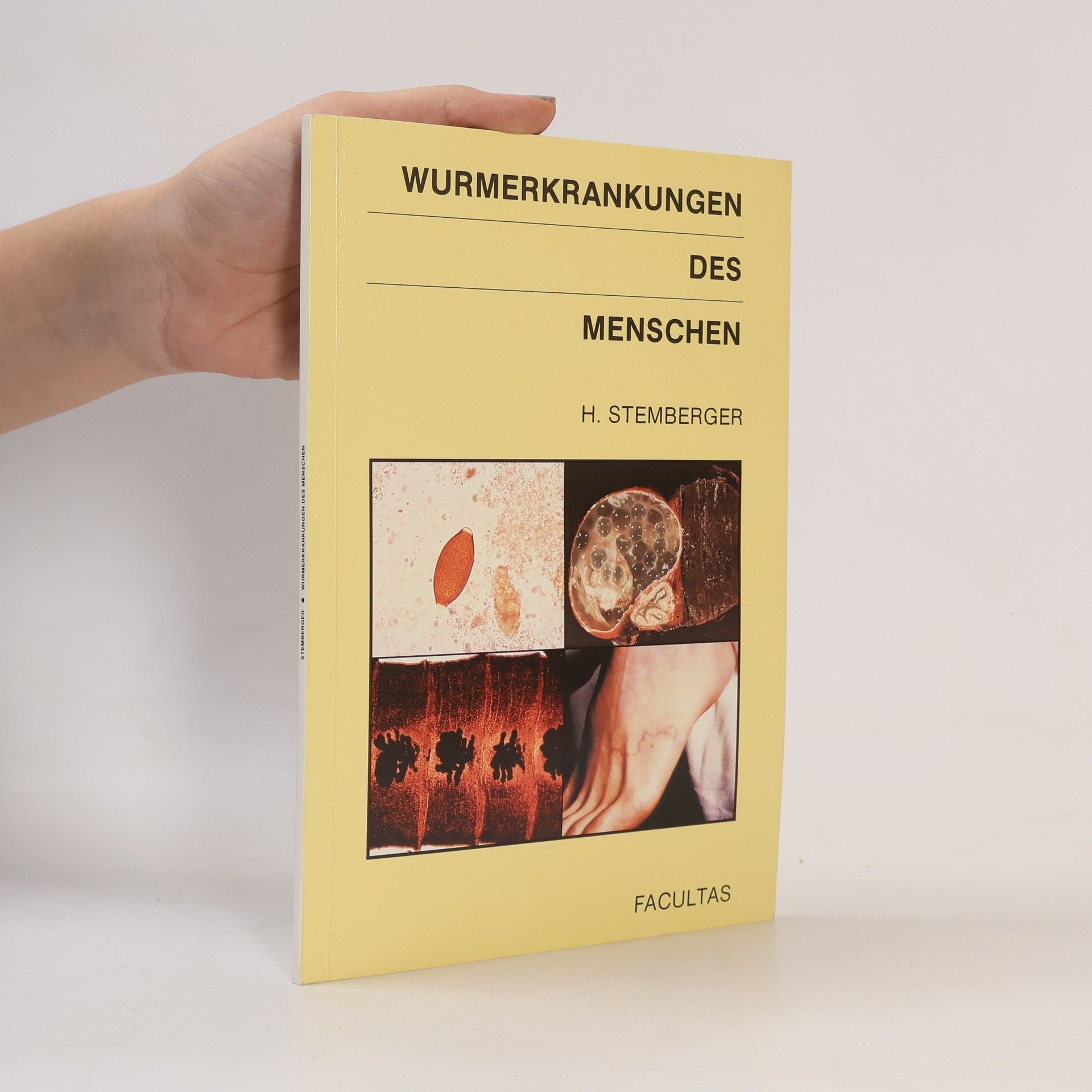 Wurmerkrankungen des Menschen