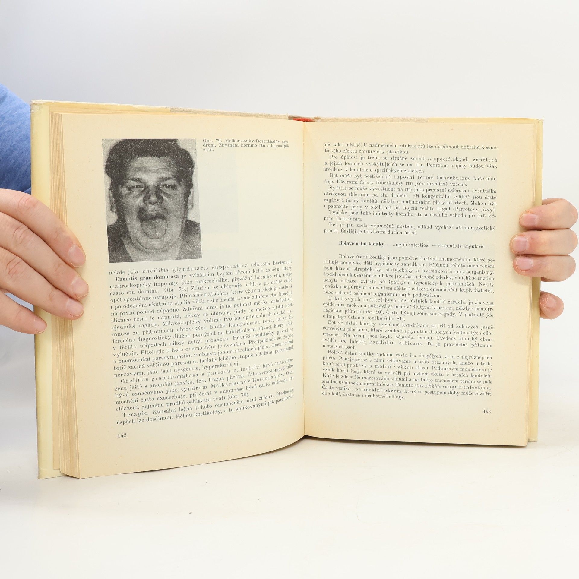 Miroslav Škach Onemocnění ústní sliznice