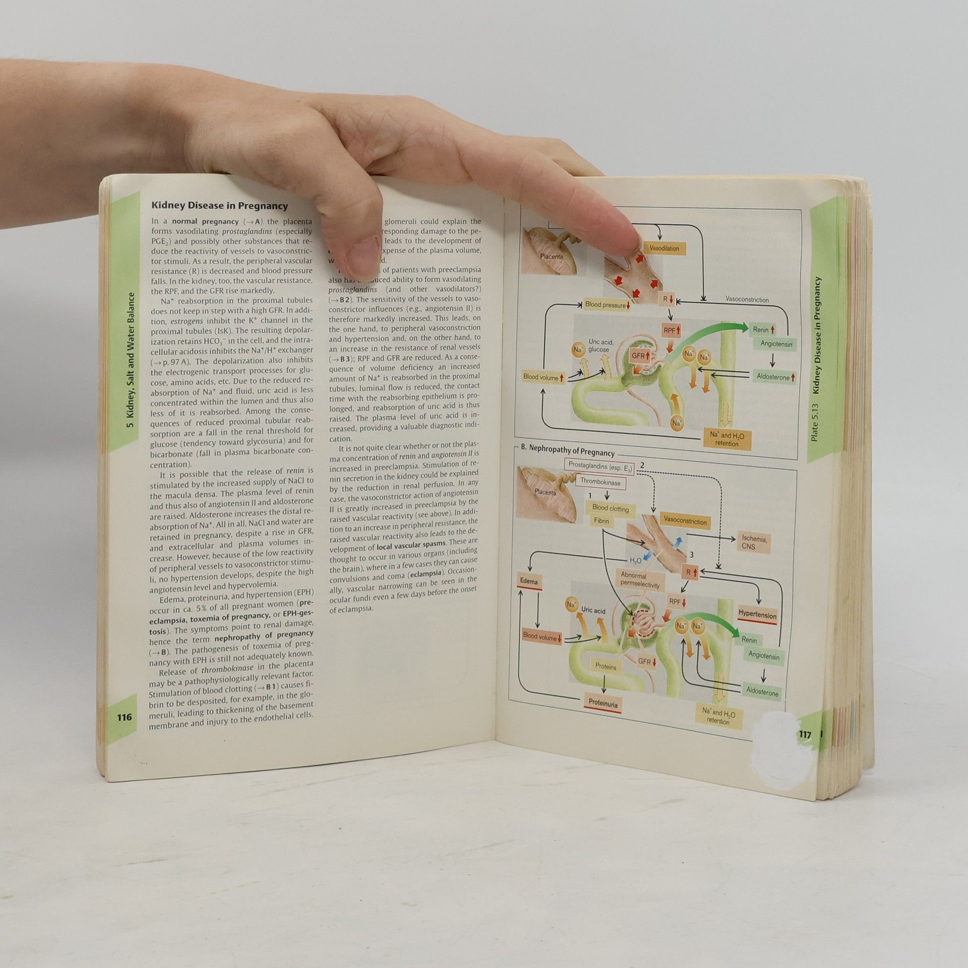 Stefan Silbernagl Thieme Flexibook: Color Atlas of Pathophysiology