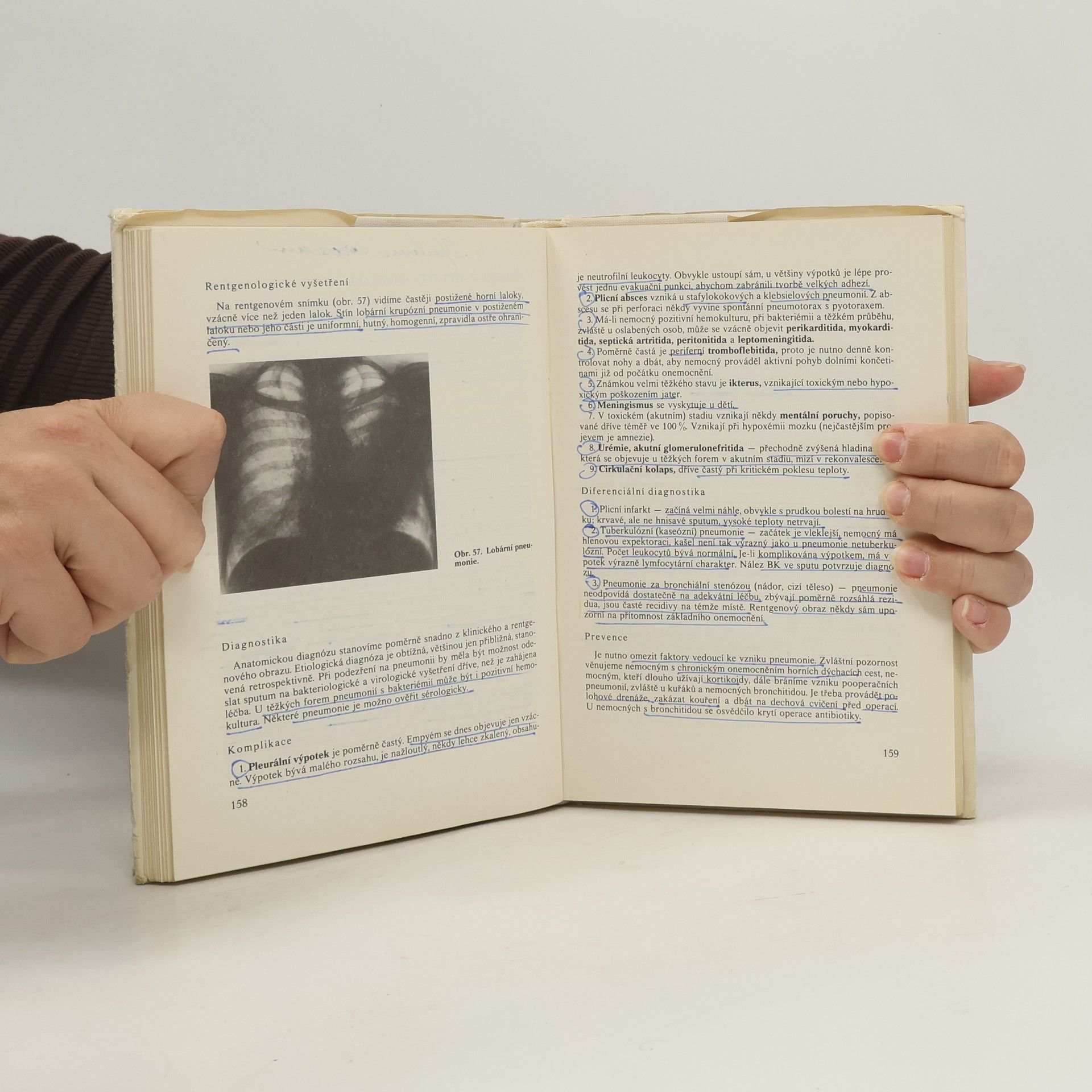 František Macholda Pneumologie