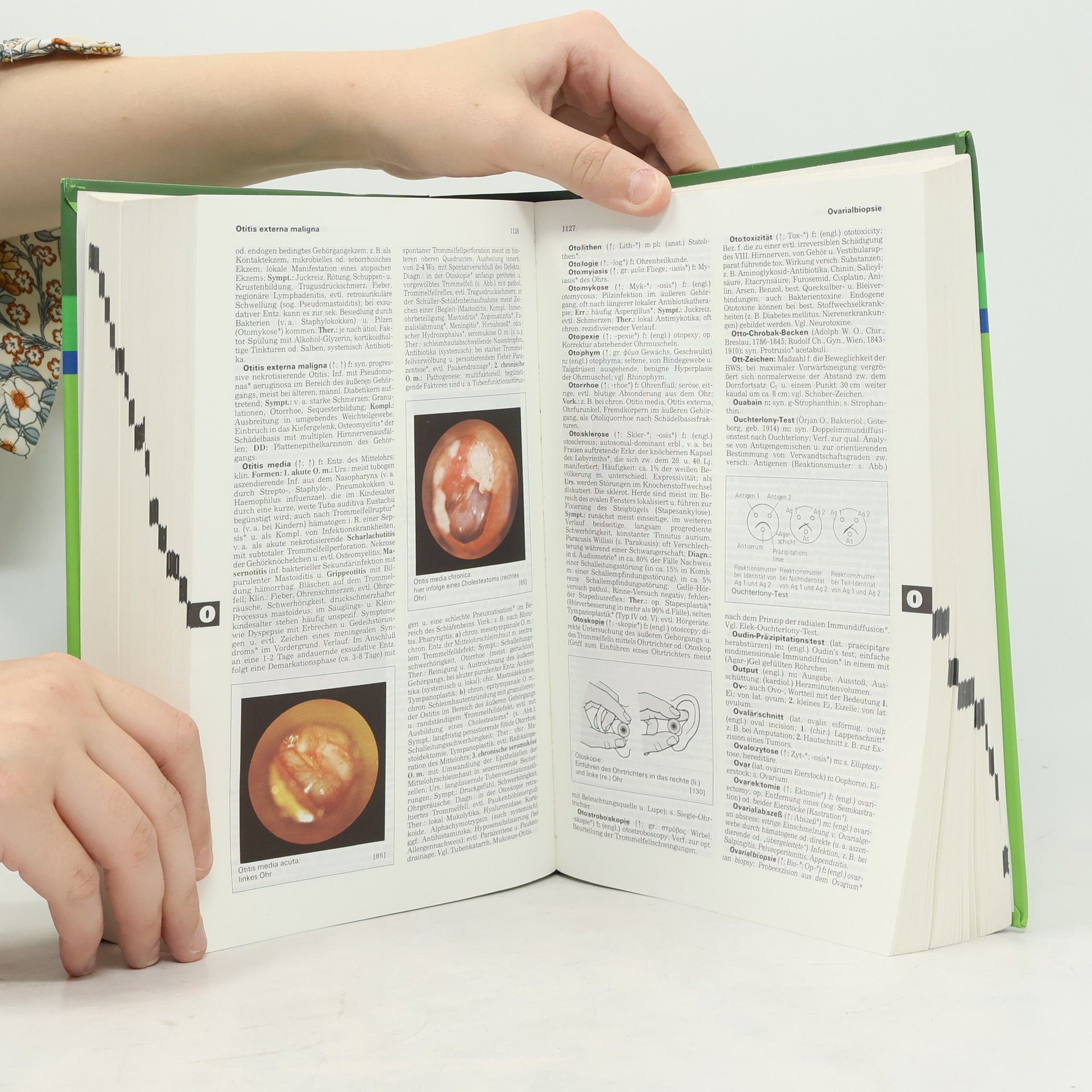 Helmut Hildebrandt Pschyrembel Klinisches Wörterbuch