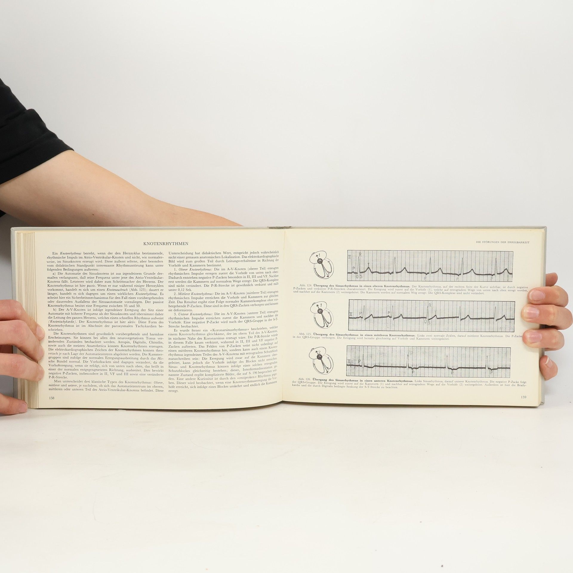 O. Ritter Atlas der Elektrokardiographie