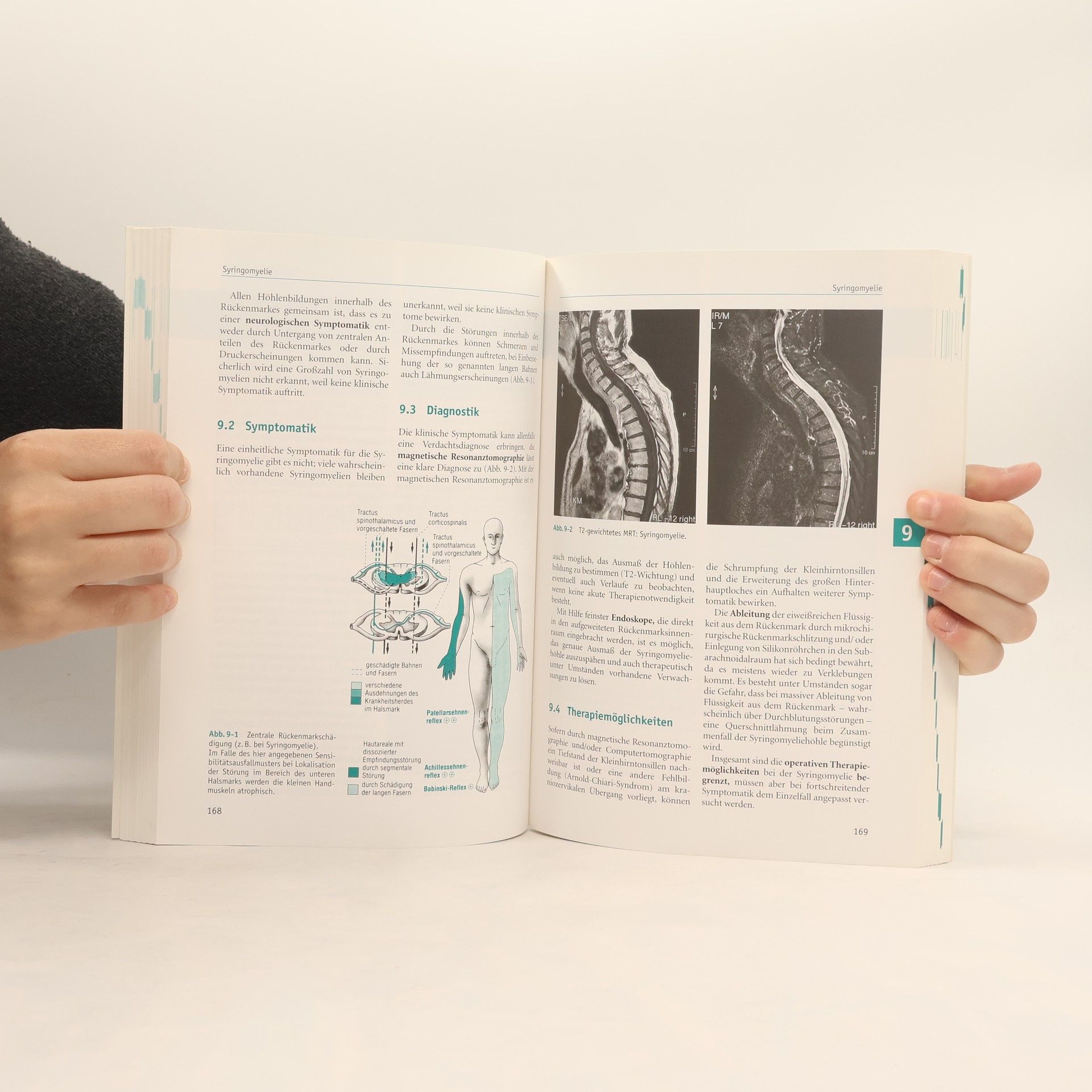 Michael Schirmer Neurochirurgie
