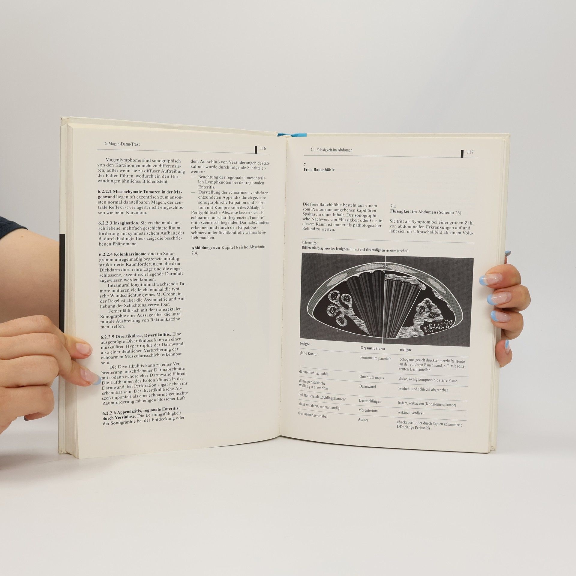 Ulrich Meckler Ultraschall des Abdomens - 2. vollständig neu bearbeitete Auflage 1989
