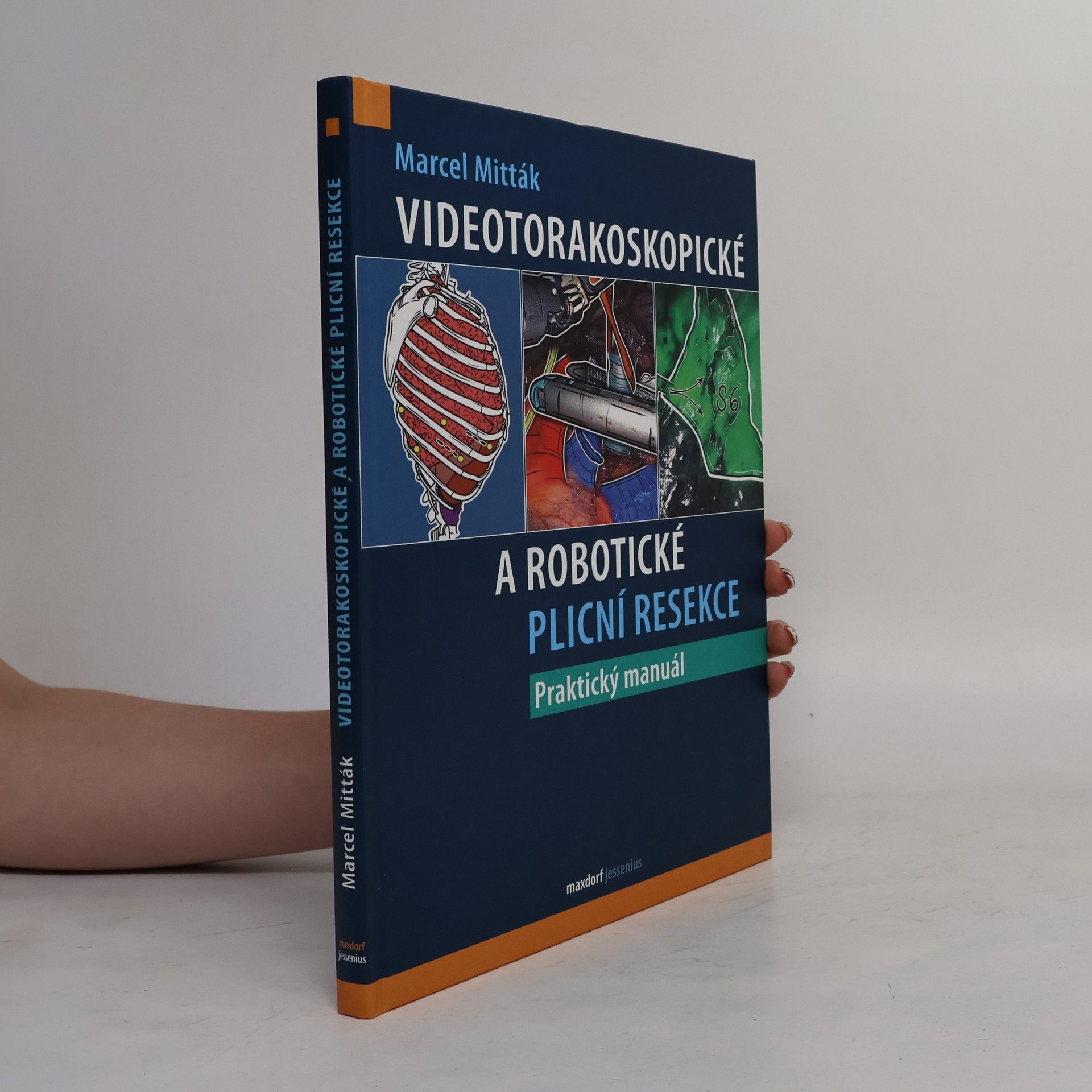 Marcel Mitták Videotorakoskopické a robotické plicní resekce