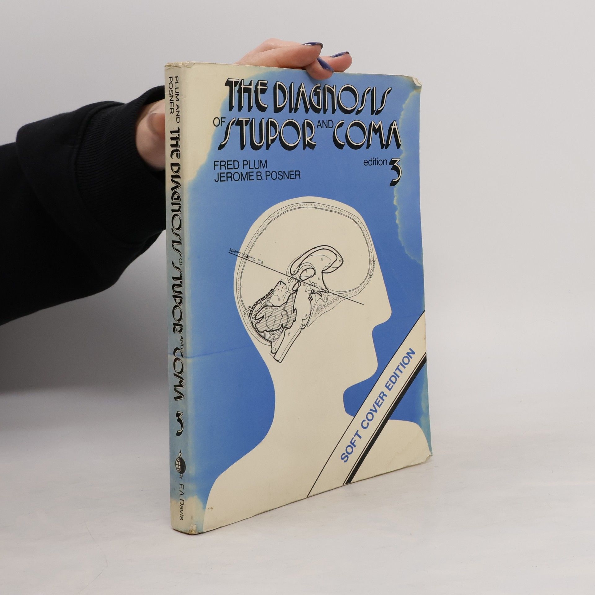 Jerome B. Posner The Diagnosis of Stupor and Coma