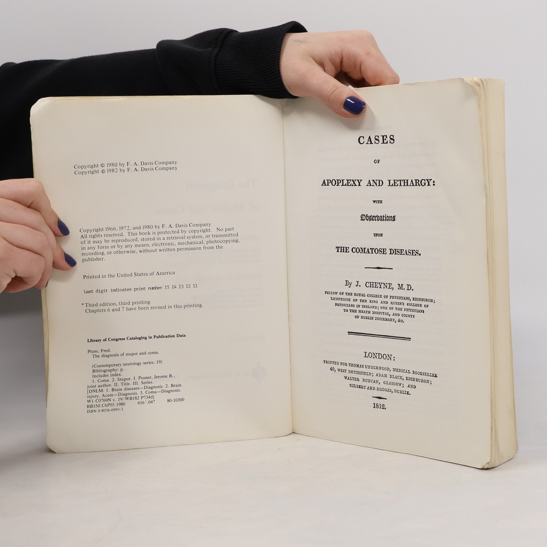 Fred Gordon Plummer The Diagnosis of Stupor and Coma