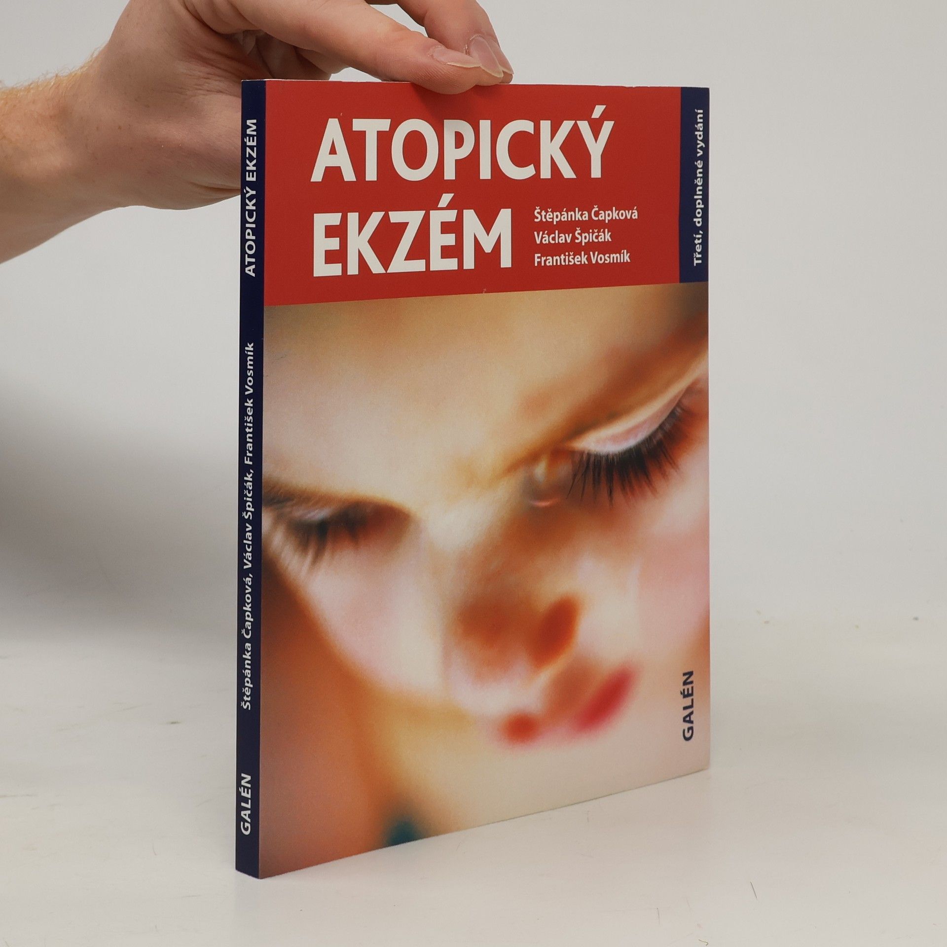 Štěpánka Čapková Atopický ekzém