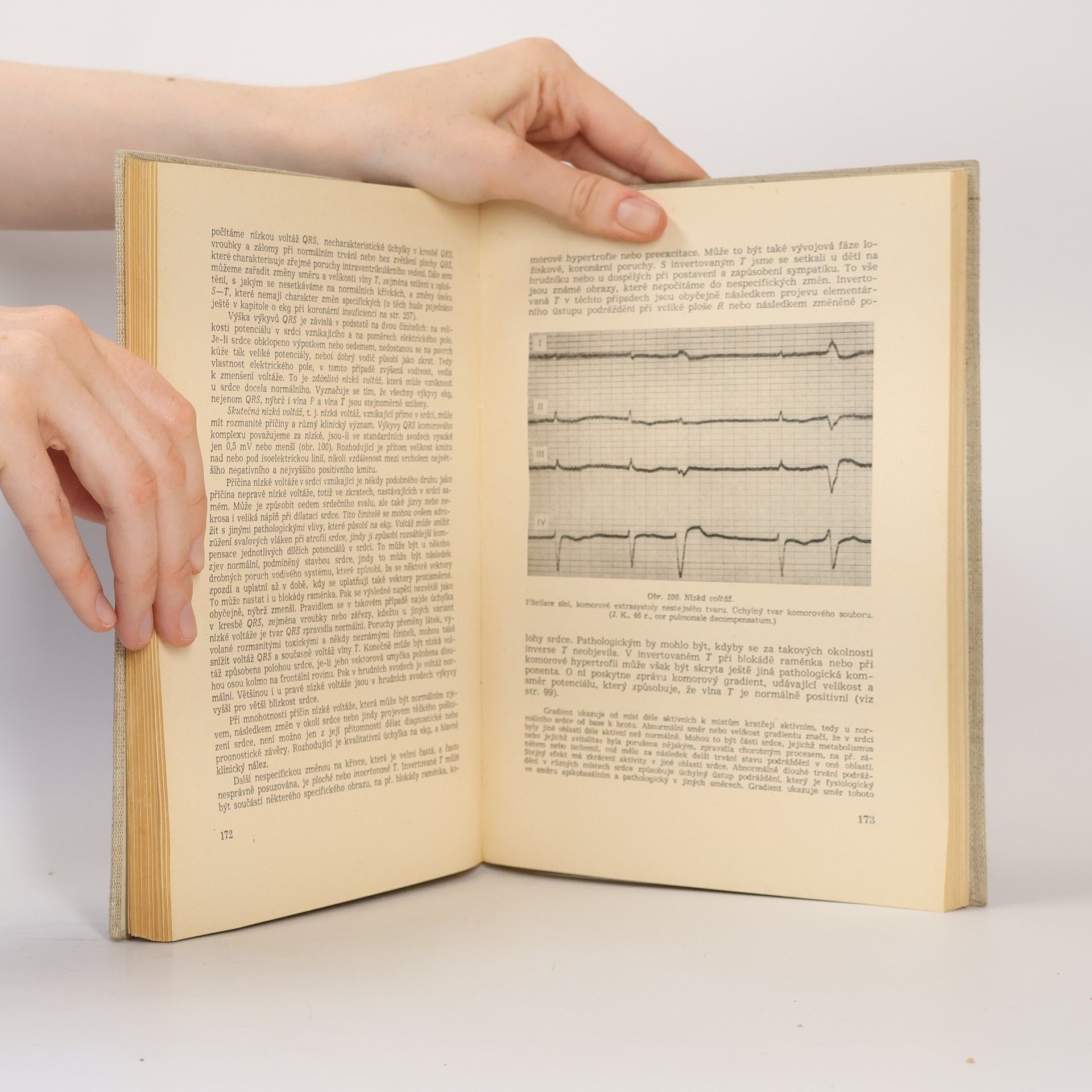 František Herles Základy elektrokardiografie