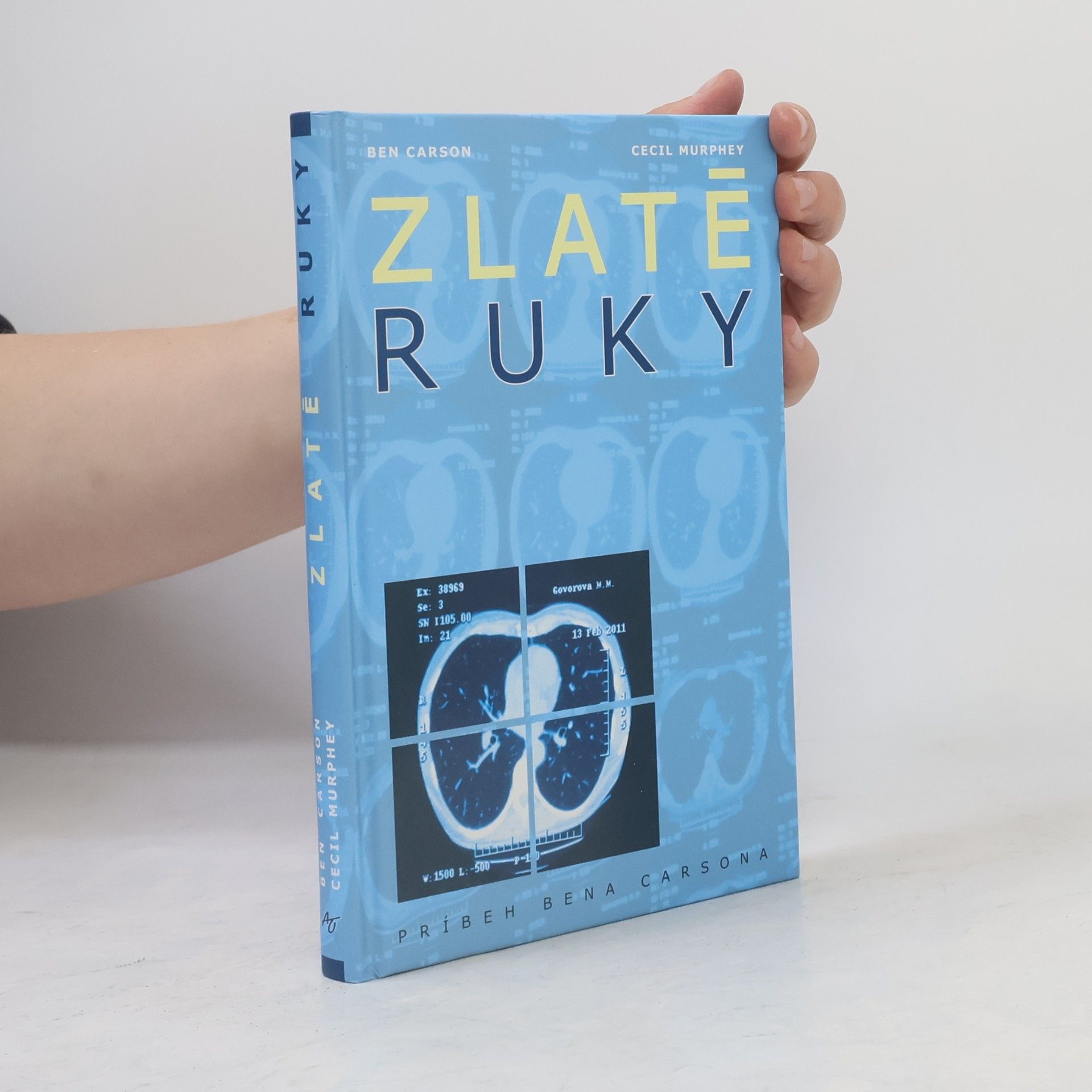 Carson Murphey Zlaté ruky
