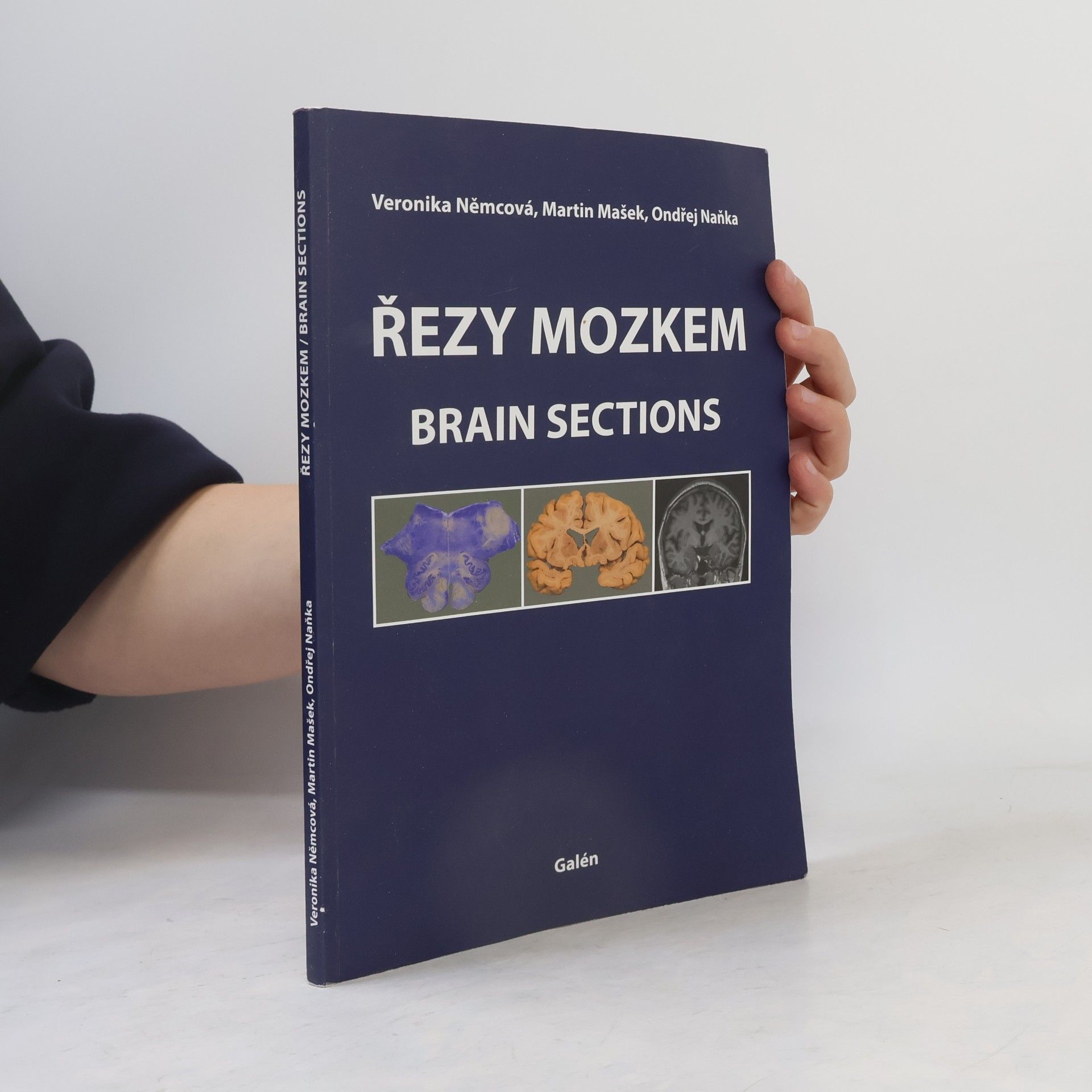 Řezy mozkem : atlas makroskopických, mikroskopických a MRI řezů = Brain sections : atlas of macroscopic, microscopic and MRI sections