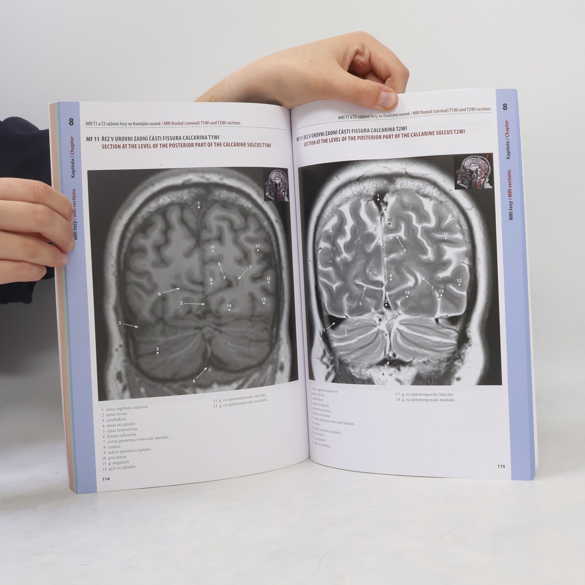 Veronika Němcová Řezy mozkem : atlas makroskopických, mikroskopických a MRI řezů = Brain sections : atlas of macroscopic, microscopic and MRI sections