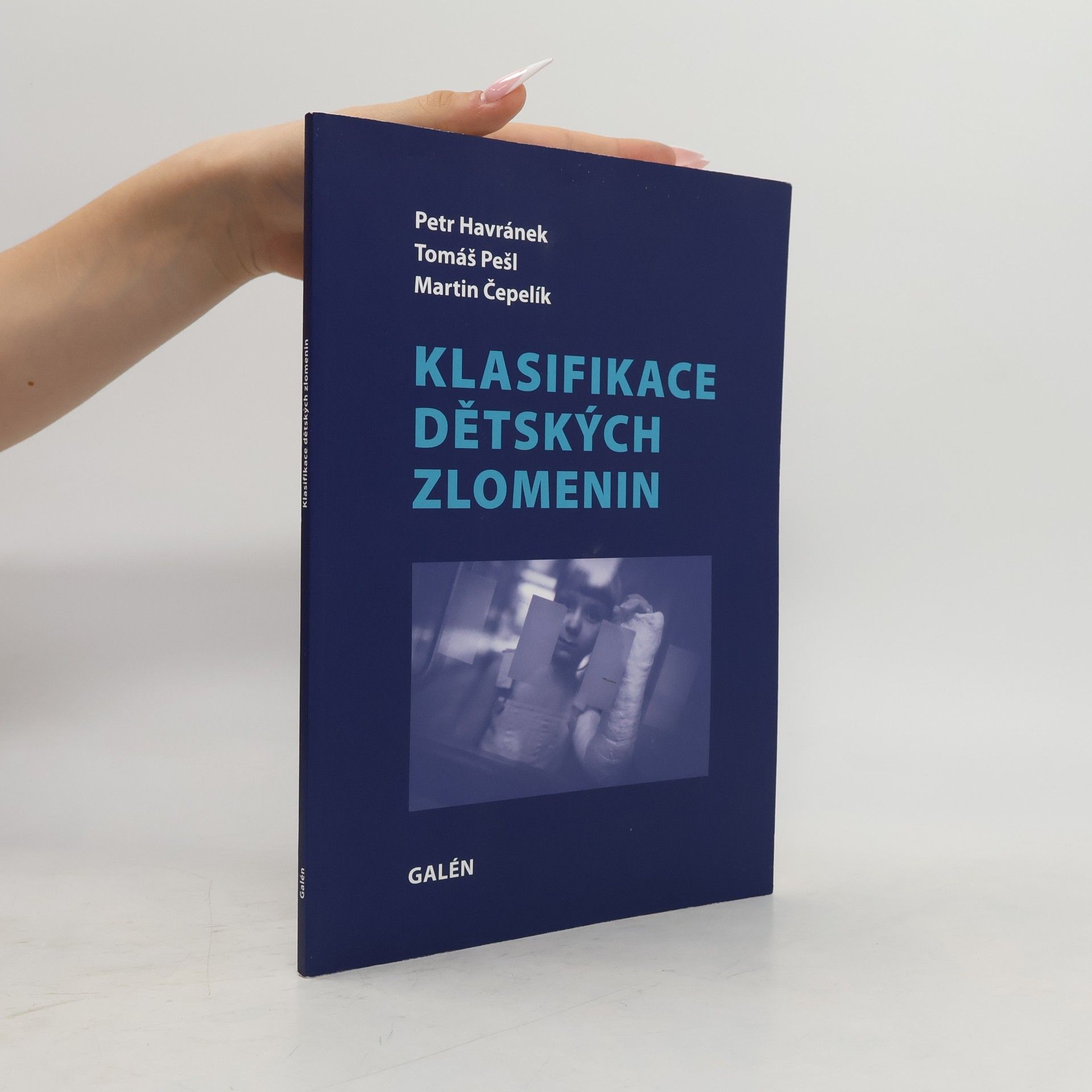 Petr Havránek Klasifikace dětských zlomenin