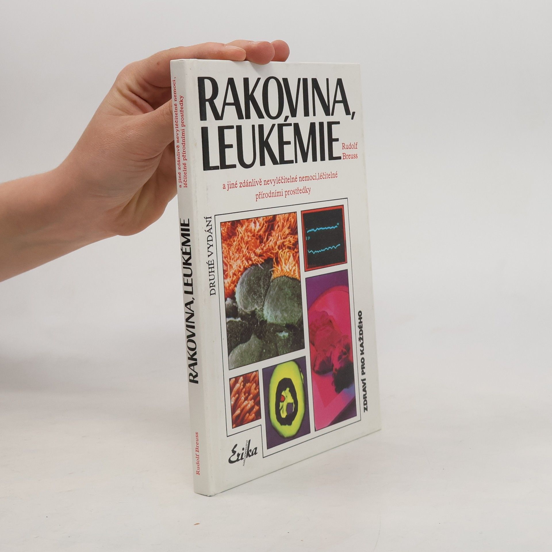Rudolf Breuss Rakovina, leukémie a jiné zdánlivě nevyléčitelné nemoci, které jsou léčitelné přírodními prostředky: Záznamy z tisíců zkušeností k blahu všeho lidstva na přání mnoha vyléčených pacientů a také na přání dobrých lékařů