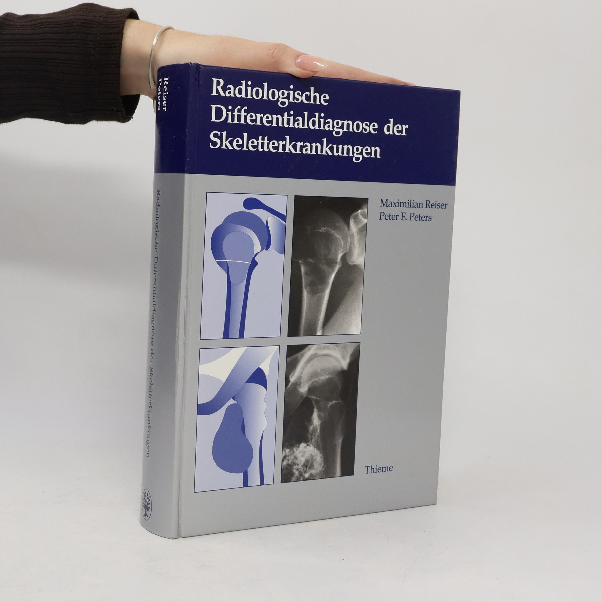Peter E. Peters Radiologische Differentialdiagnose der Skeletterkrankungen