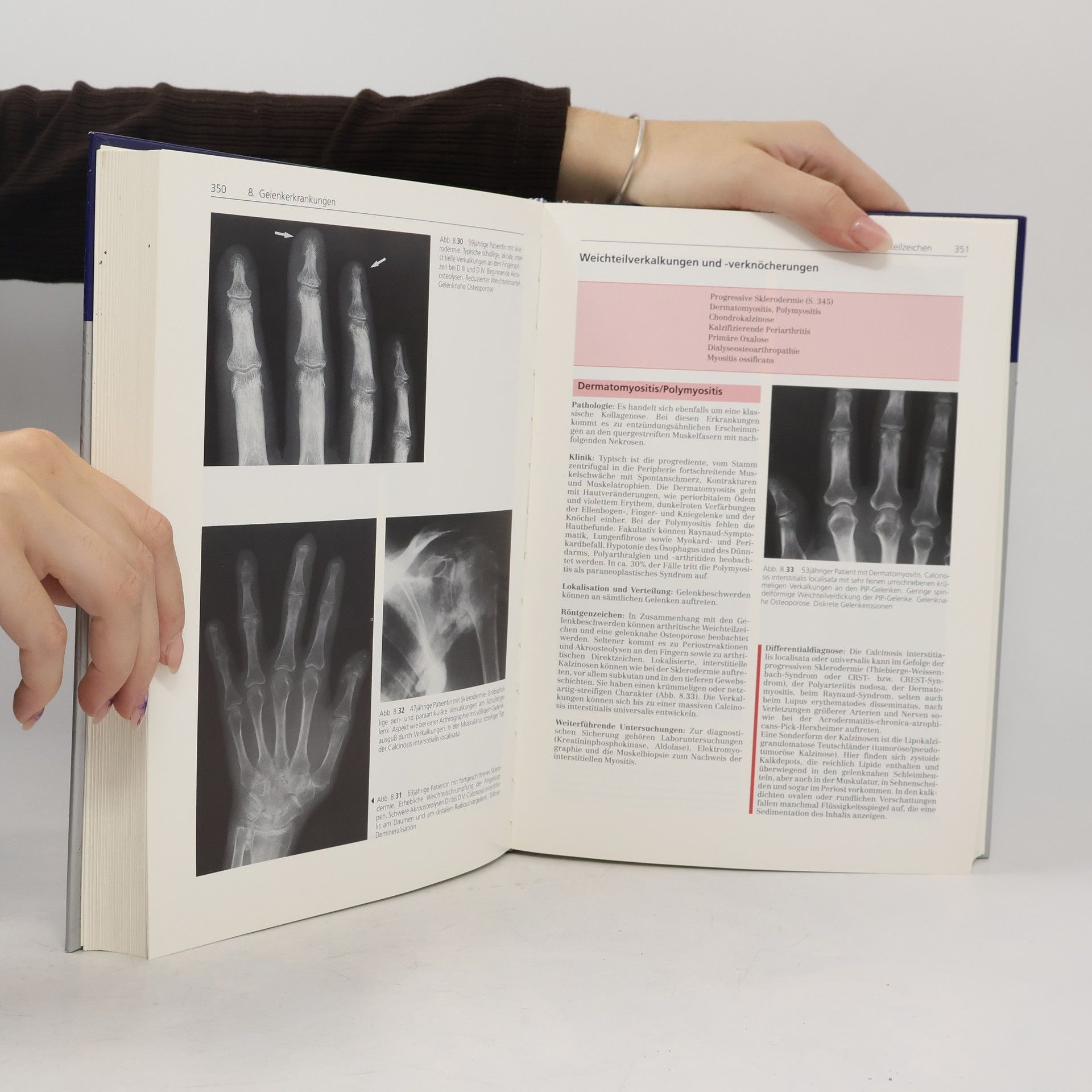 Maximilian Reiser Radiologische Differentialdiagnose der Skeletterkrankungen
