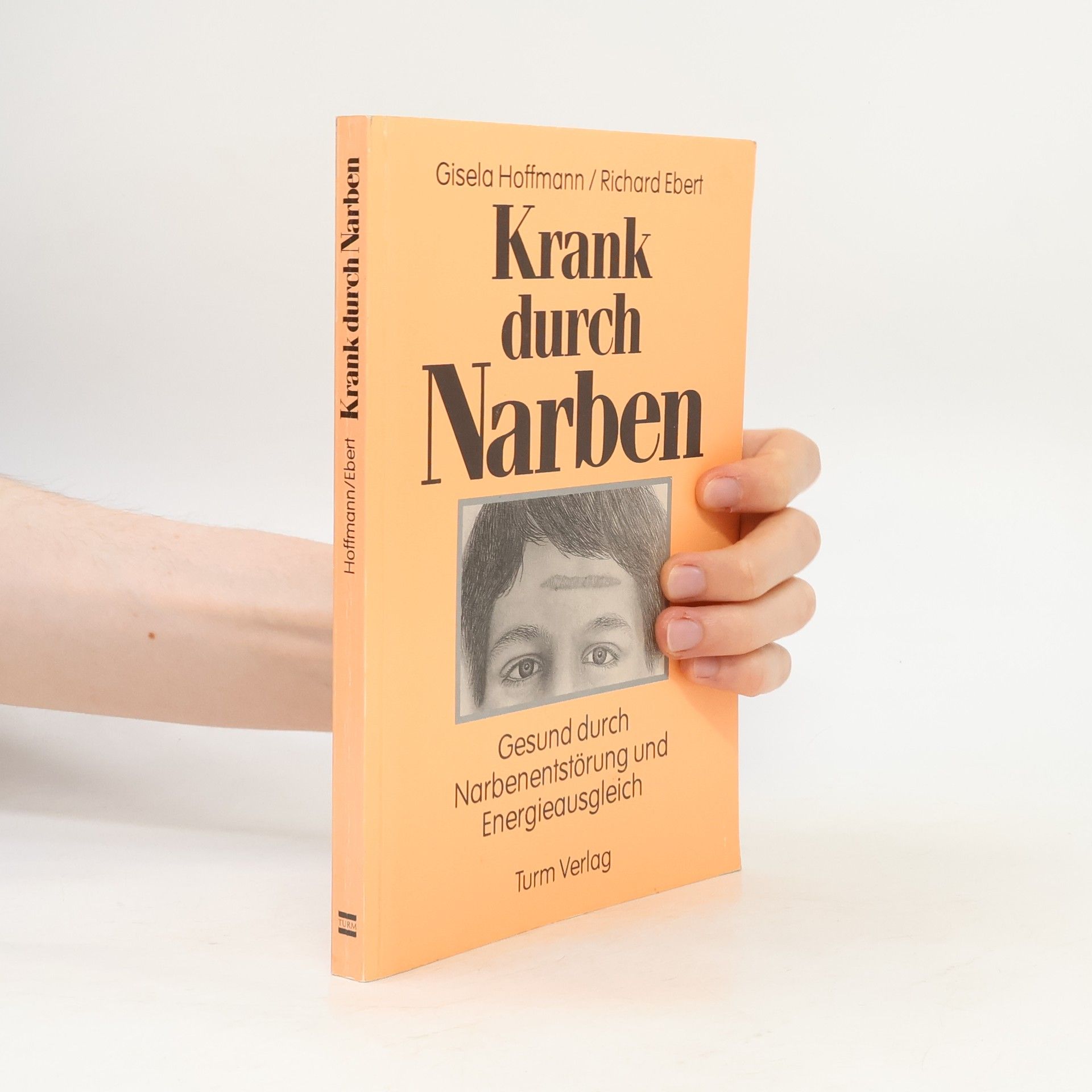 Gisela Hoffmann Krank durch Narben
