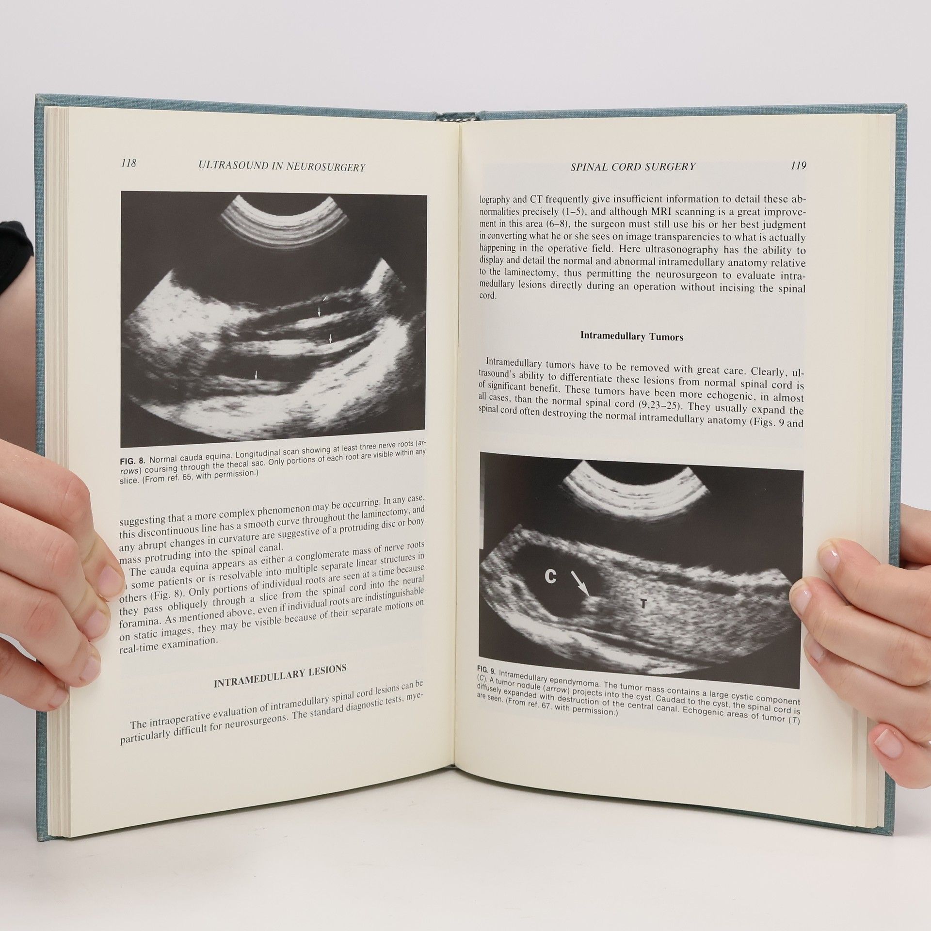Jonathan M. Rubin Ultrasound in Neurosurgery