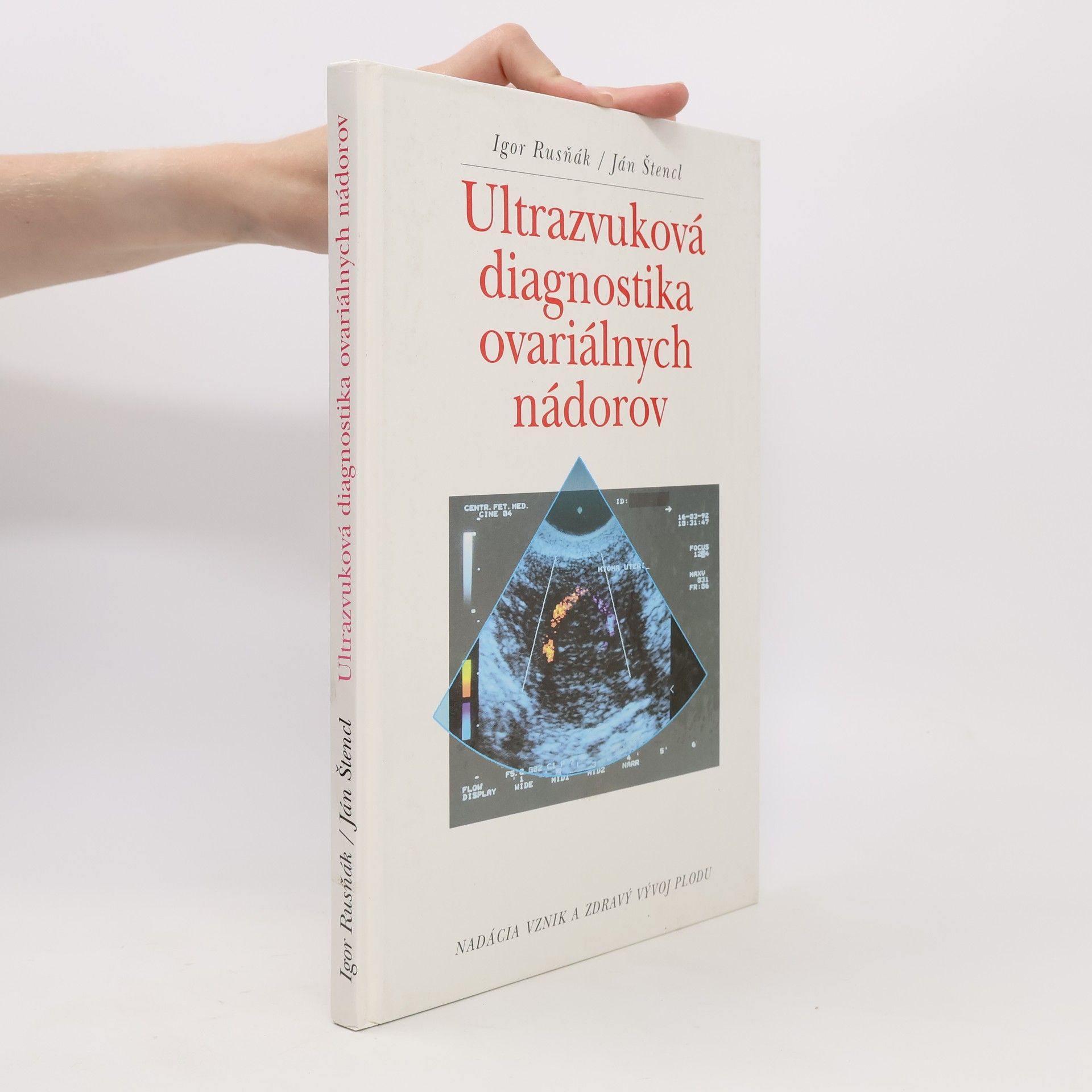 Ultrazvuková diagnostika ovariálnych nádorov