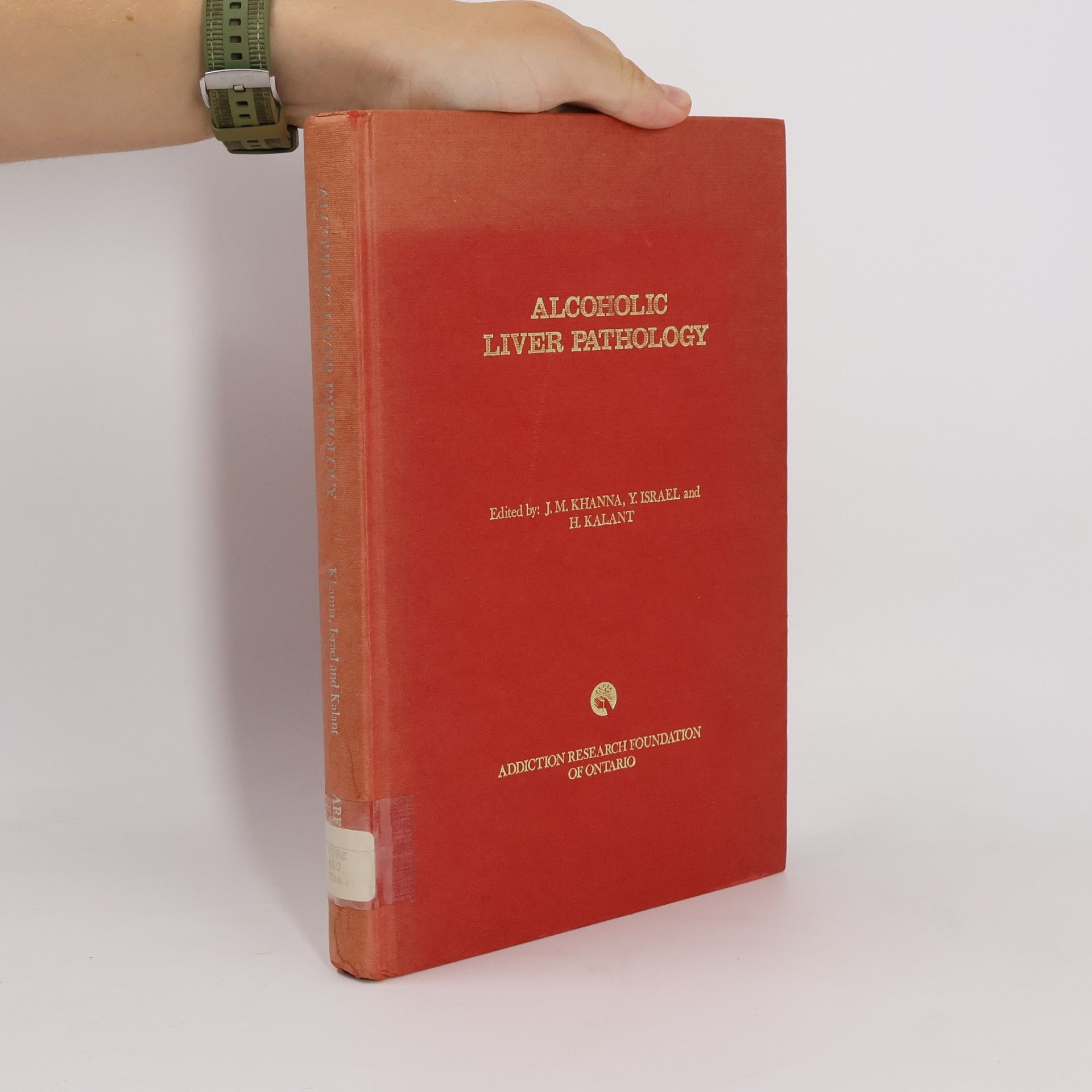 H. Kalant Alcoholic Liver Pathology
