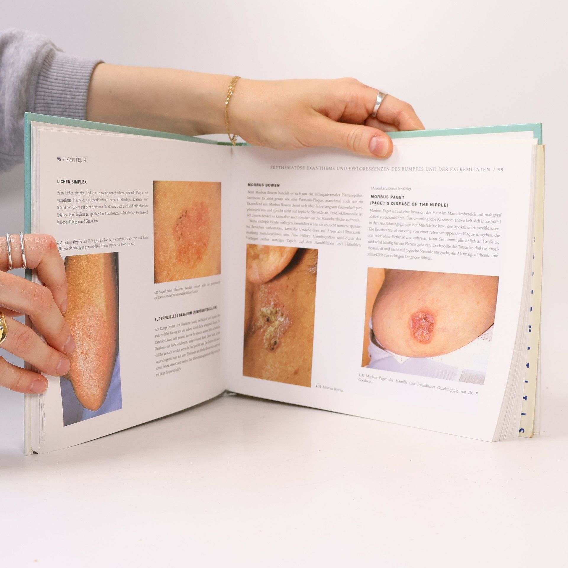Richard Ashton Differential Diagnosis In Dermatology