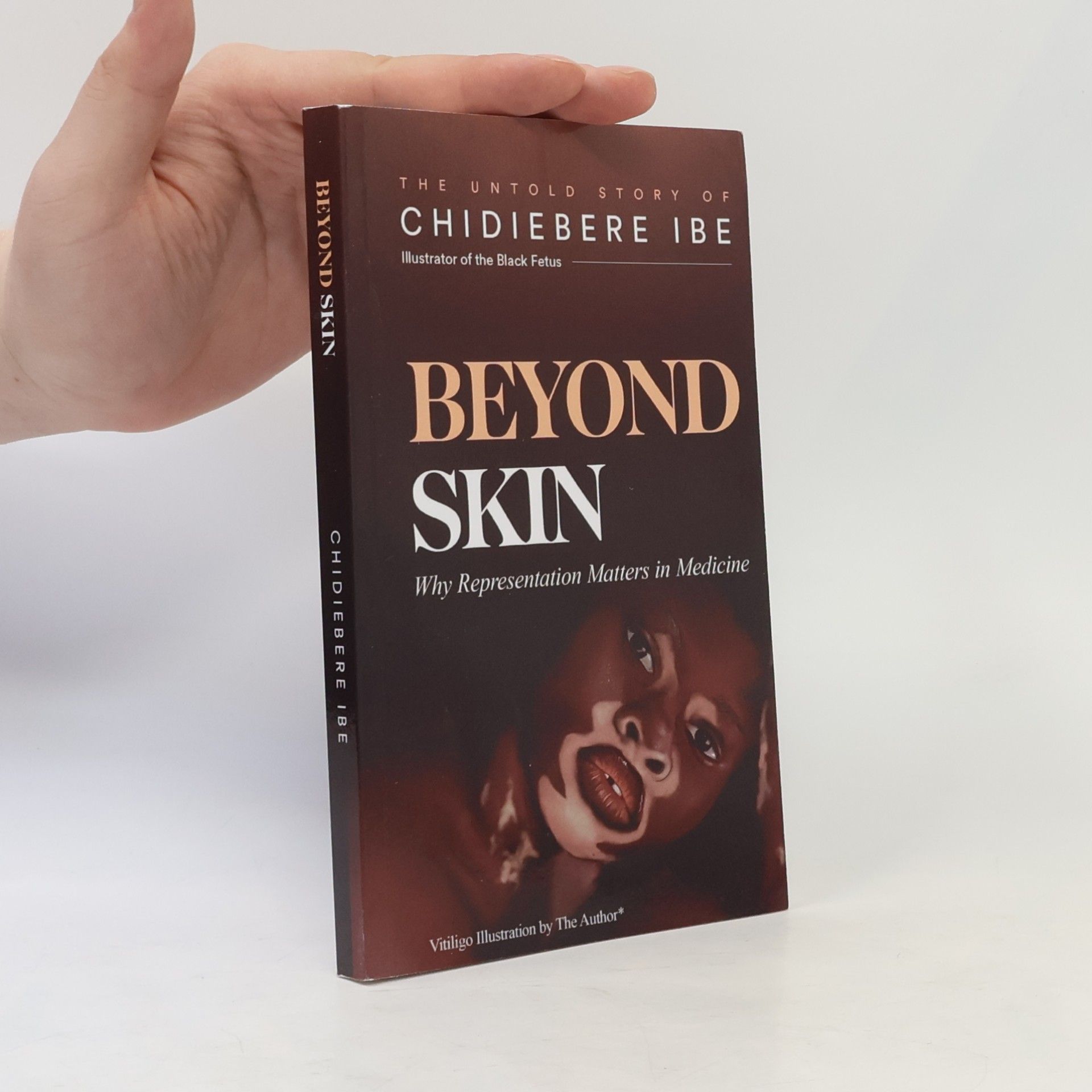 Chidiebere Sunday Ibe Beyond Skin